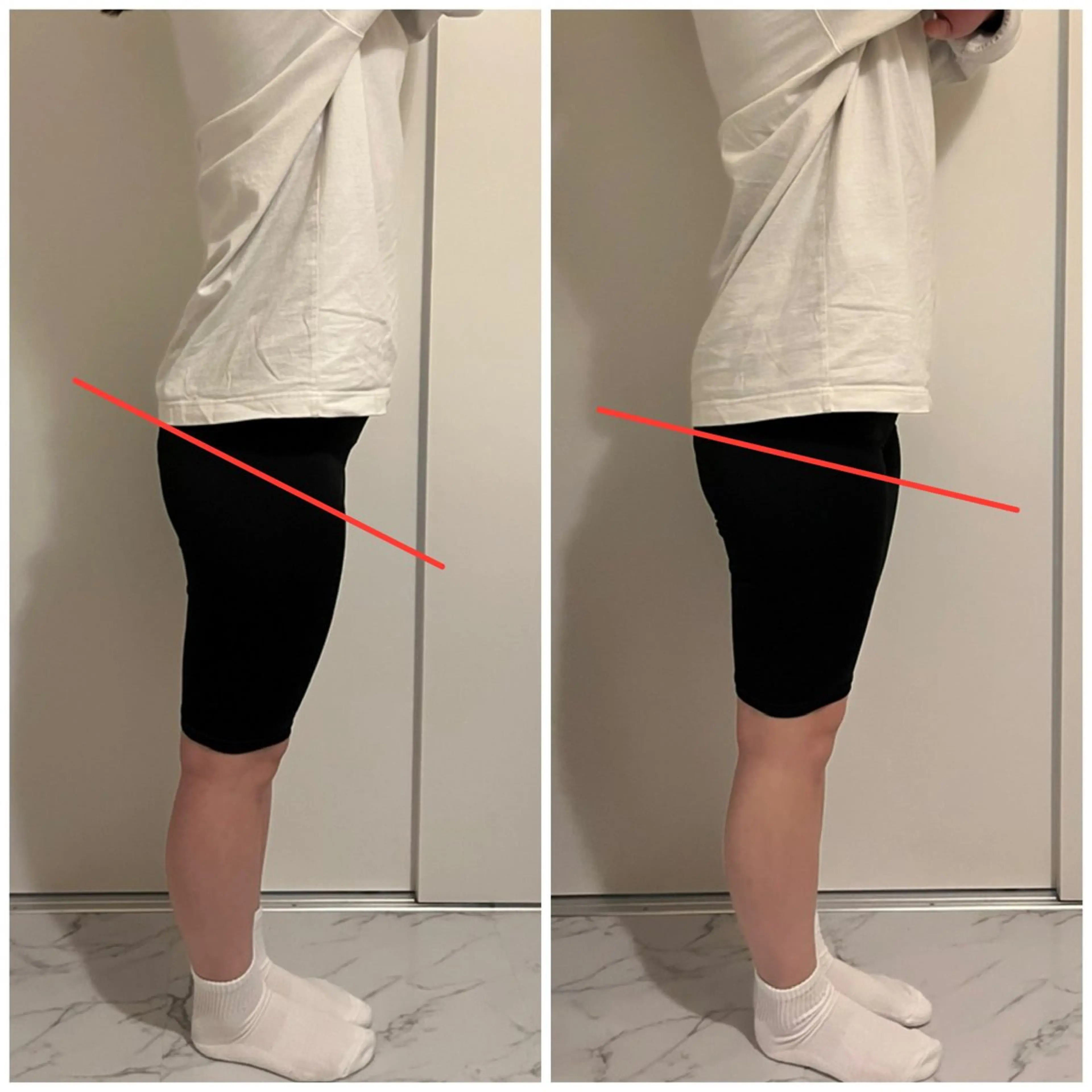 《minimo限定✨》骨盤矯正60分⭐️の写真