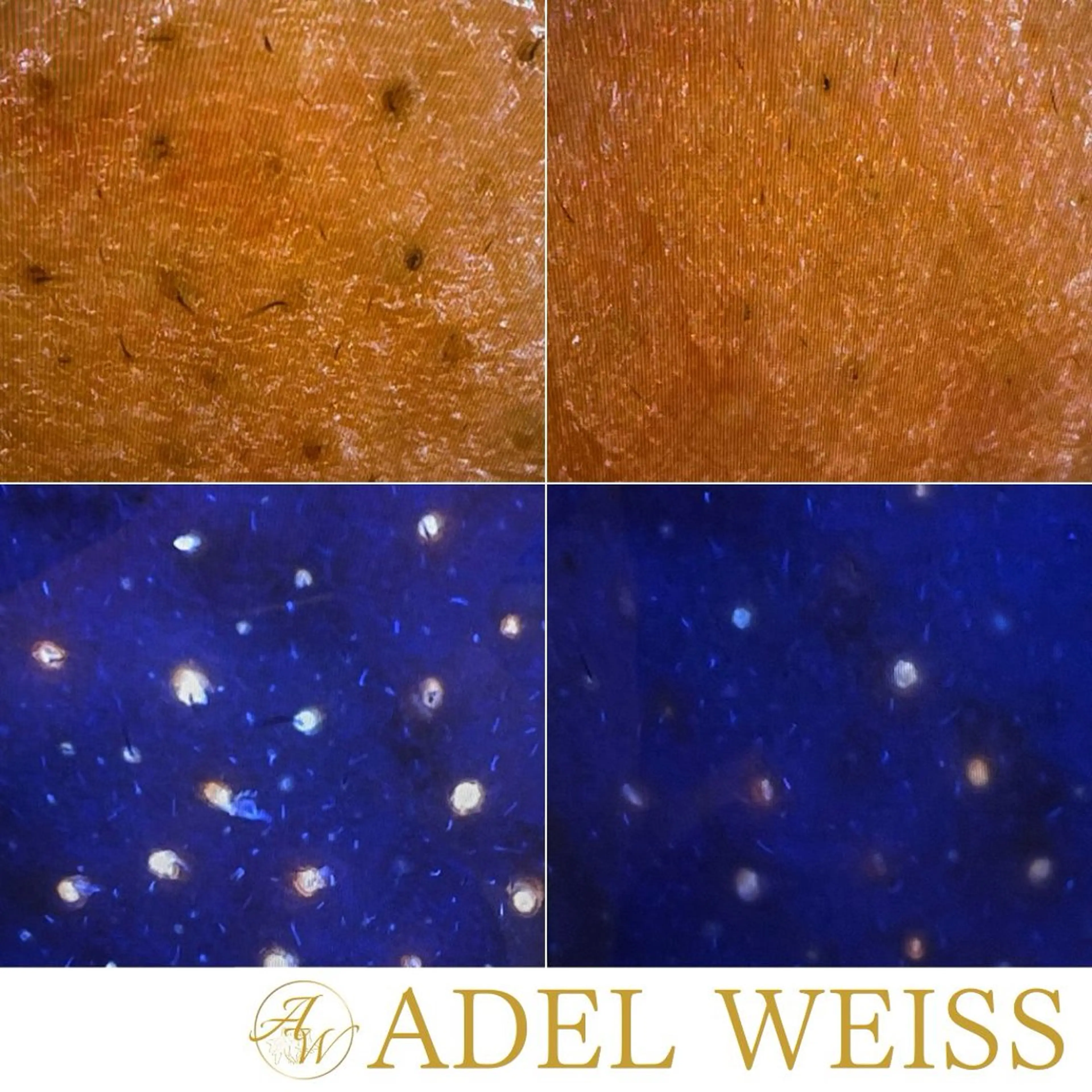 エステ リラク Total Beauty Salon　ADEL WEISS所属・ADEL WEISS 脱毛＆毛穴＆リンパのエステ・リラクイメージ