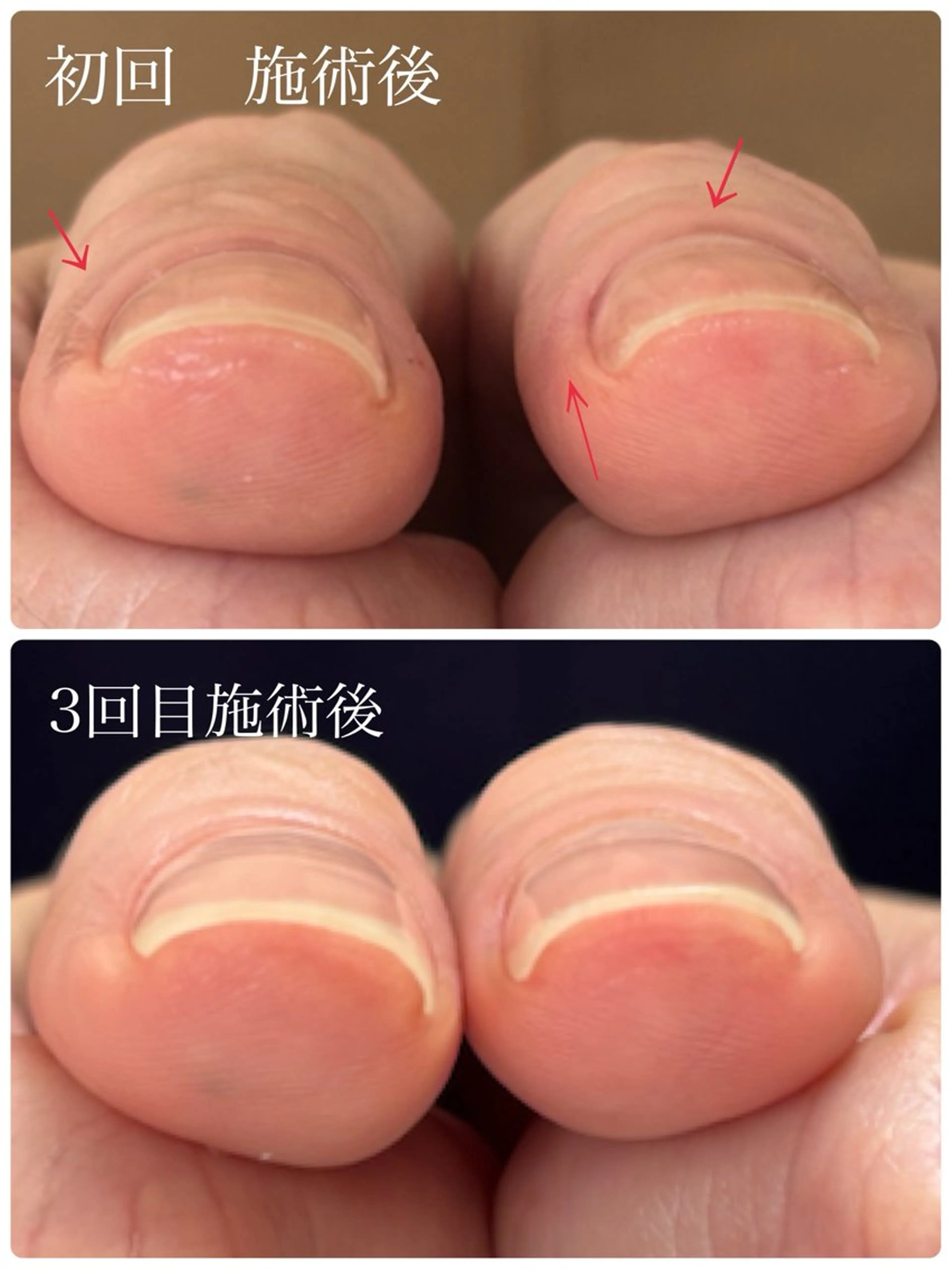 ネイル Alo.nail アロ•ネイルのネイルデザイン