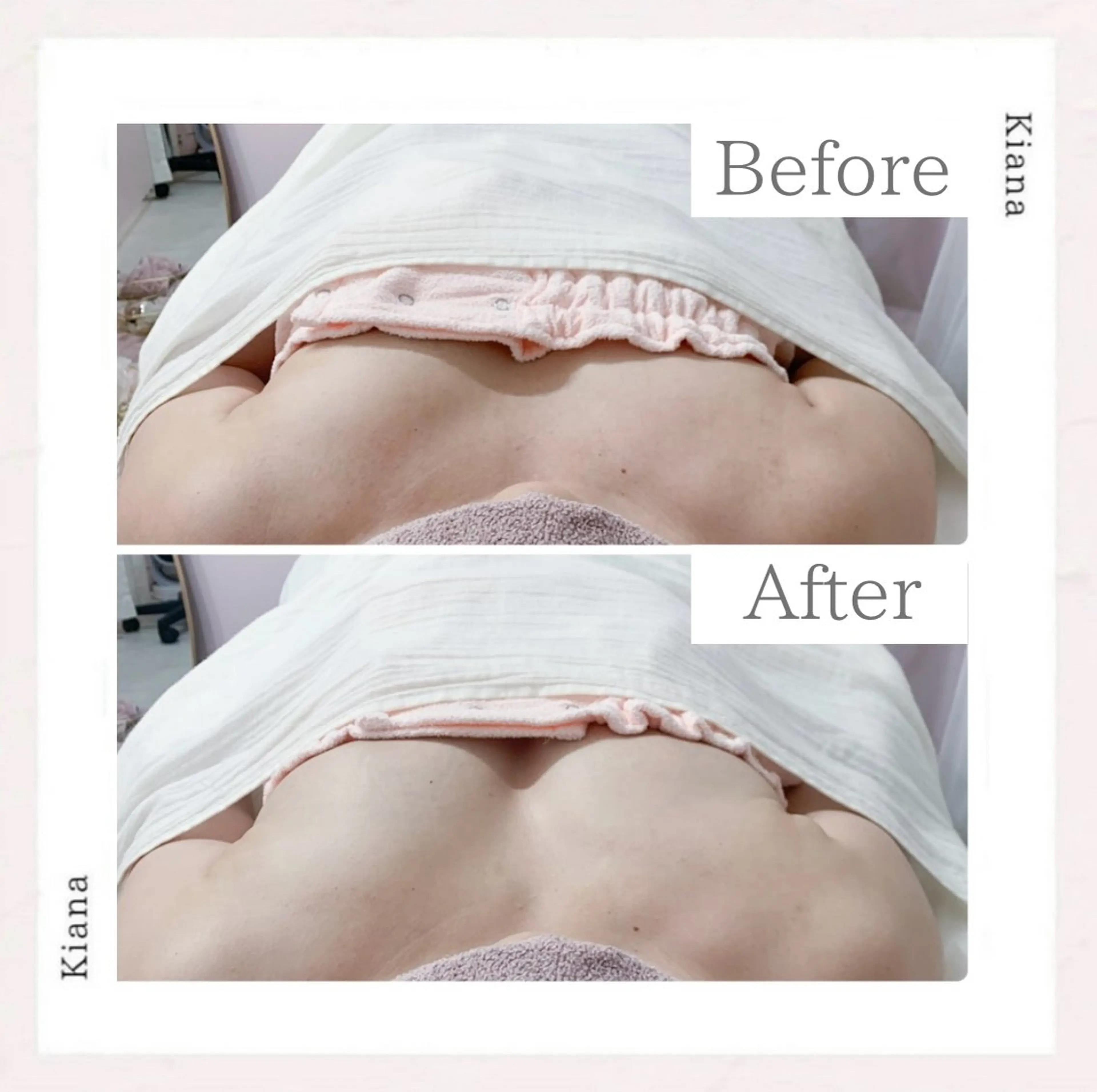 エステ リラク バスト専門Kiana 風のエステ・リラクイメージ