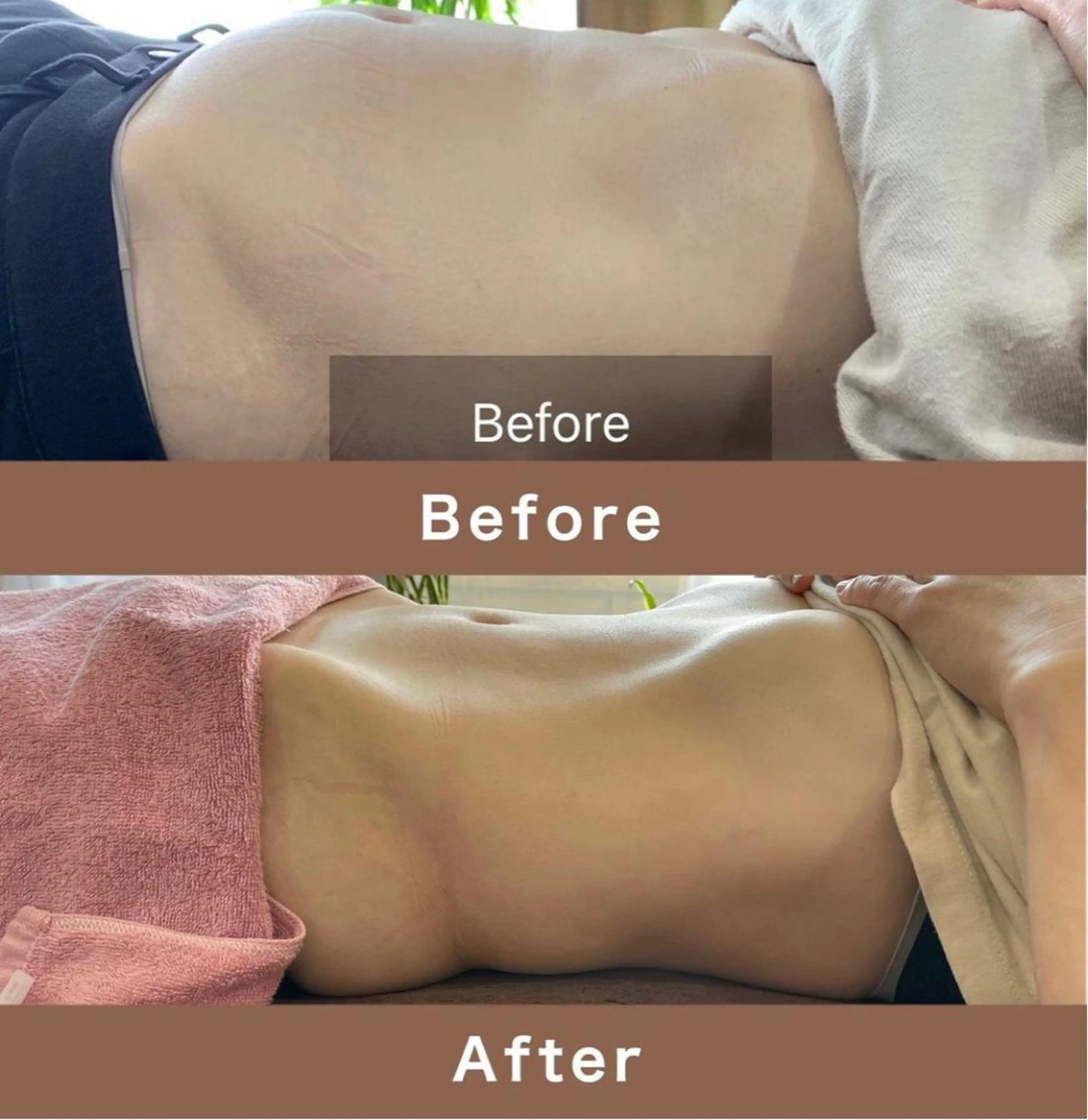 オイル腸セラピー60分【下腹部ぽっこり・便秘・腸内環境改善・免疫力アップ・美肌】の写真