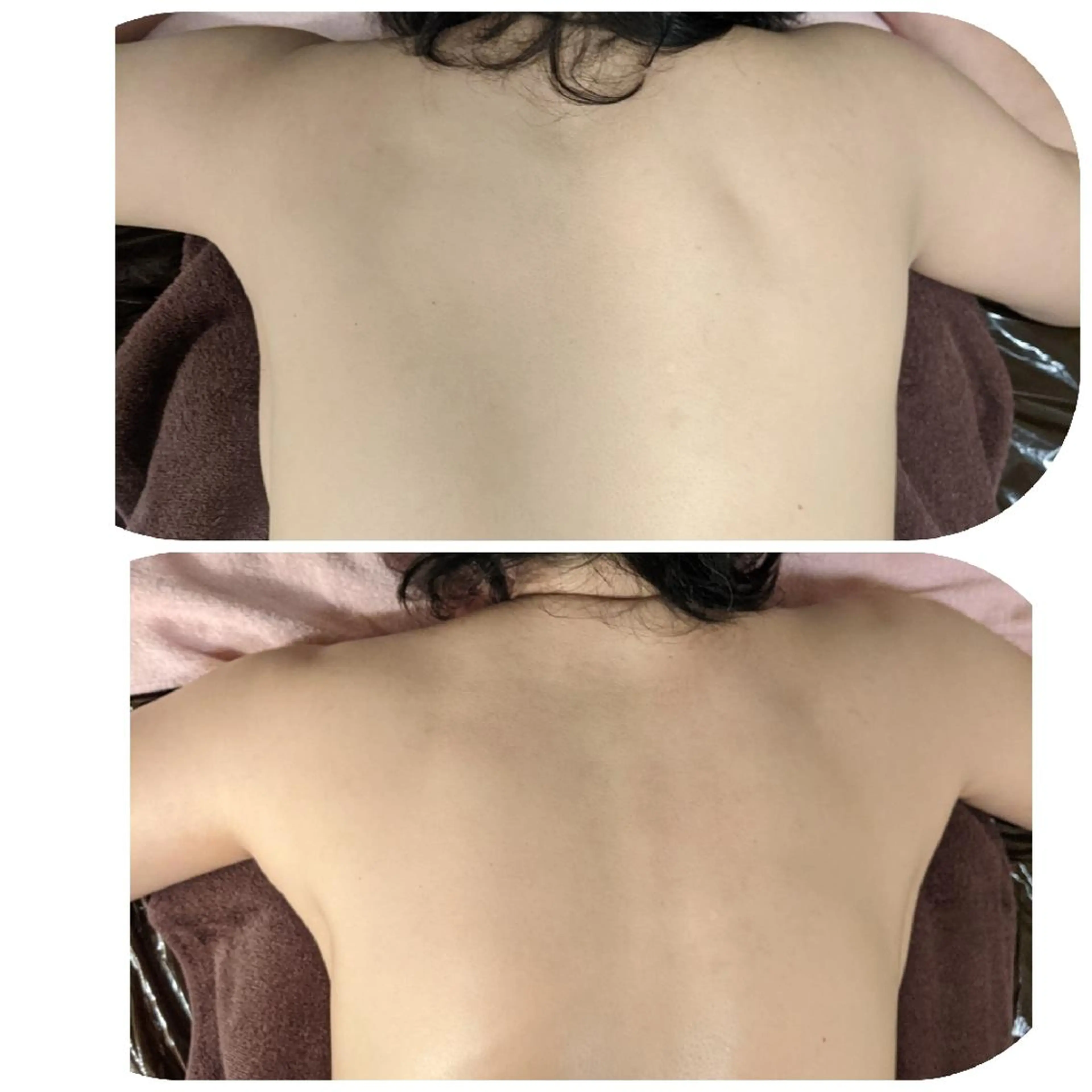 整体エステ　NEW ME所属・深層リンパオイル/小 顔とドライヘッドスパのエステ・リラクイメージ