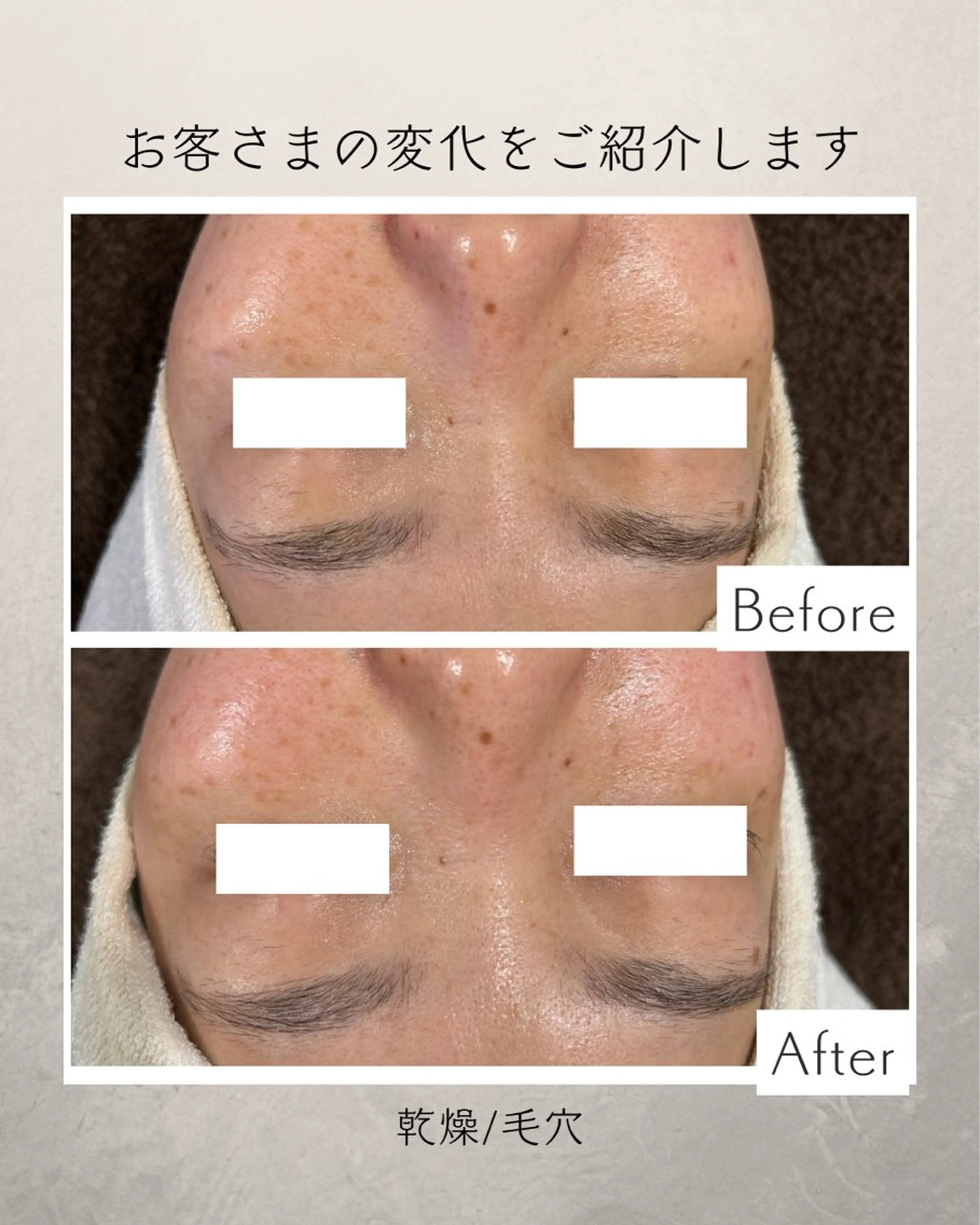 エステ リラク プライベートサロン COVOのエステ・リラクイメージ