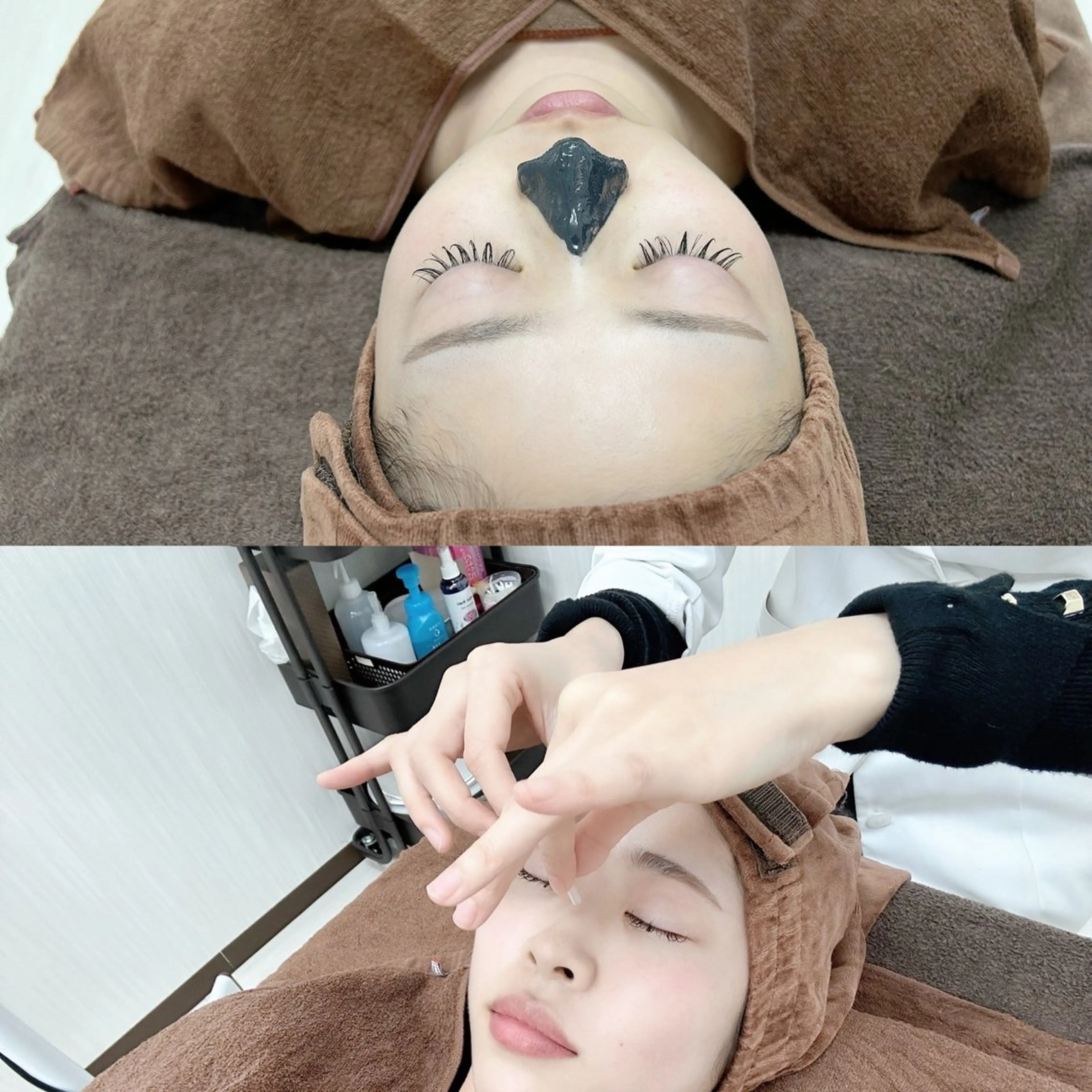 美容鍼灸専門院　ハリエッセンス所属・美容鍼専門鍼灸院 ハリエッセンスのその他イメージ