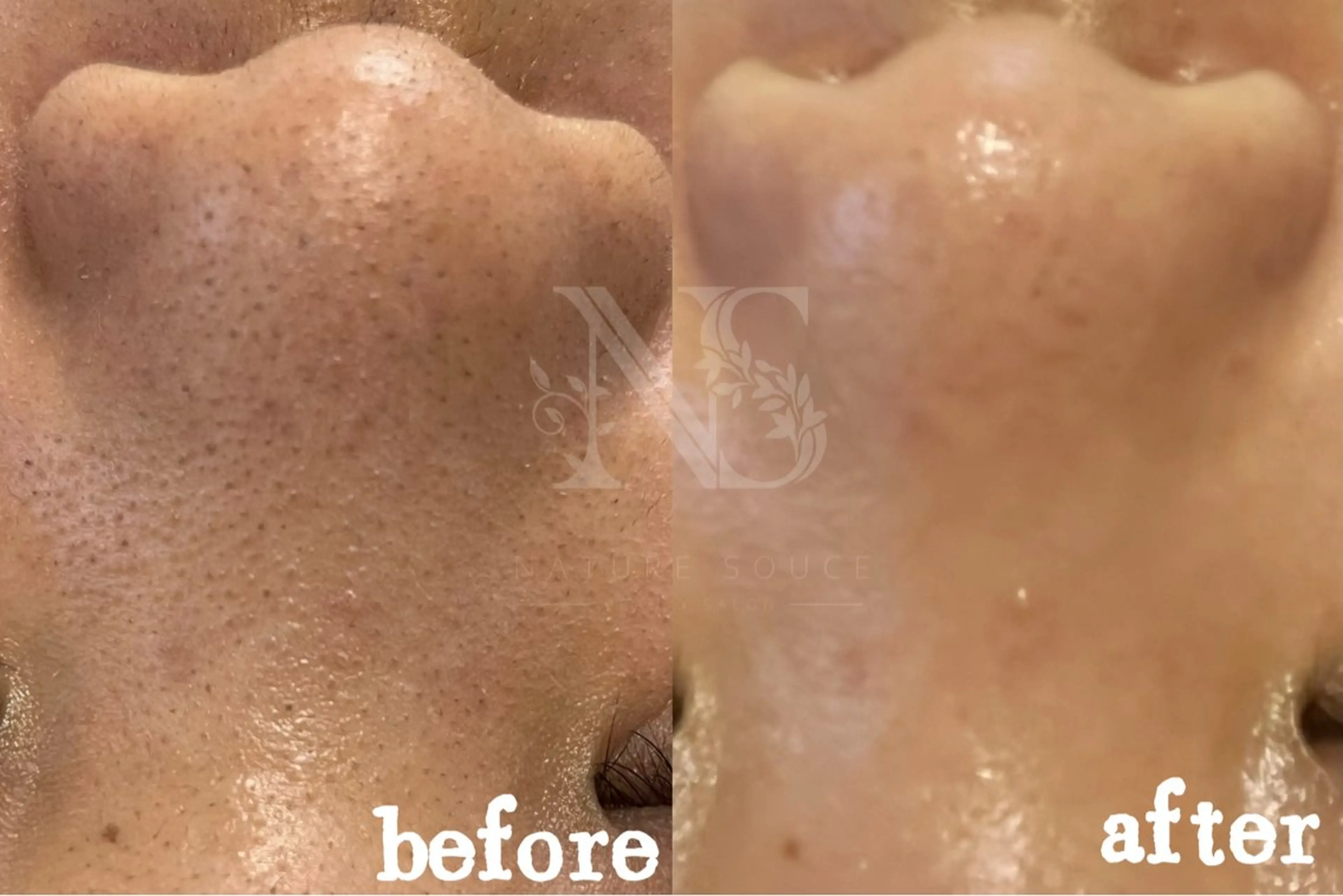 Nature Souce毛穴専門店のその他イメージ