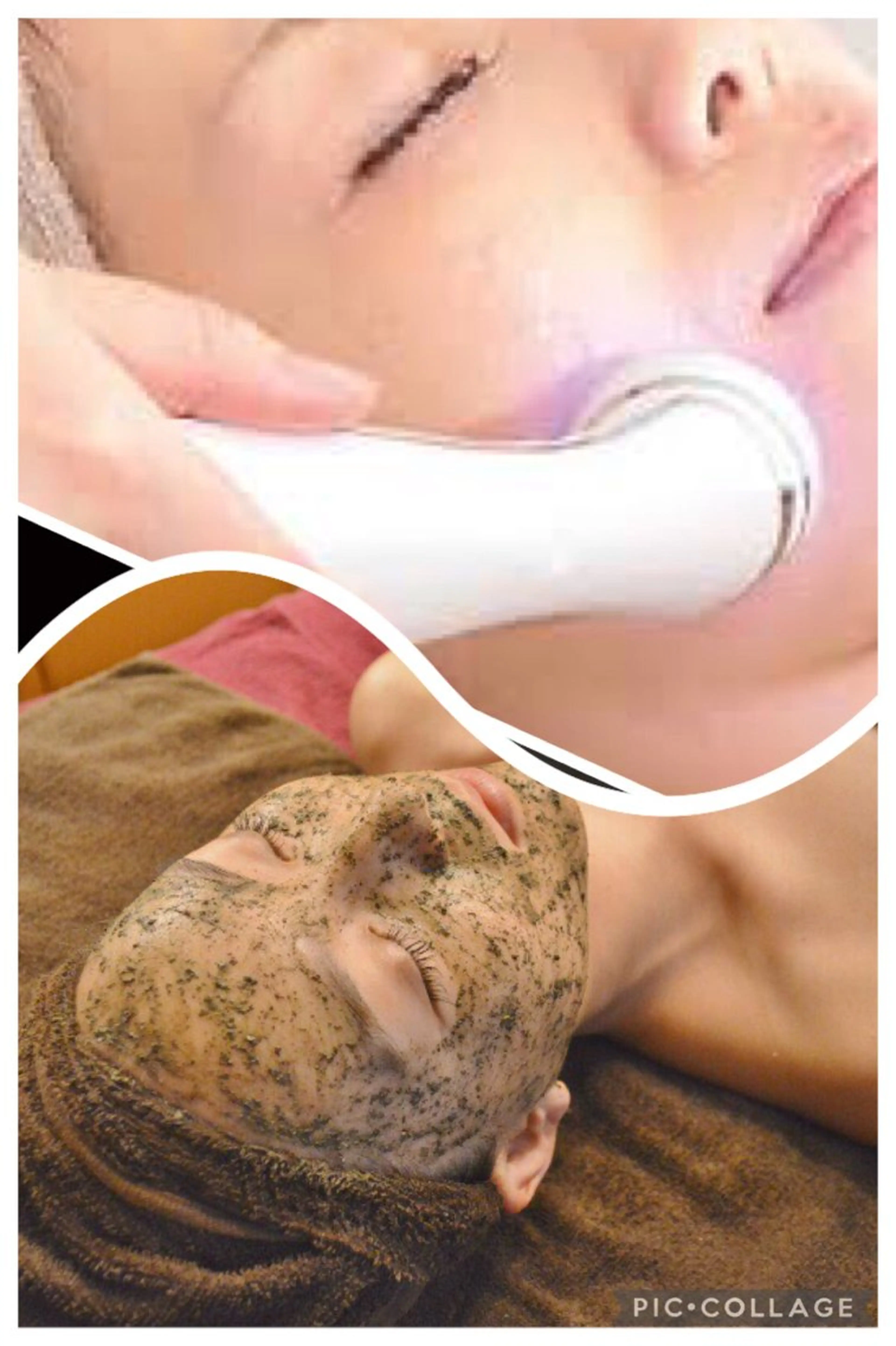 12/29.30限定💎✨REVI陶肌トリートメント1g🌹＋lemonbottle導入🍋肌質改善、小顔、たるみにの写真