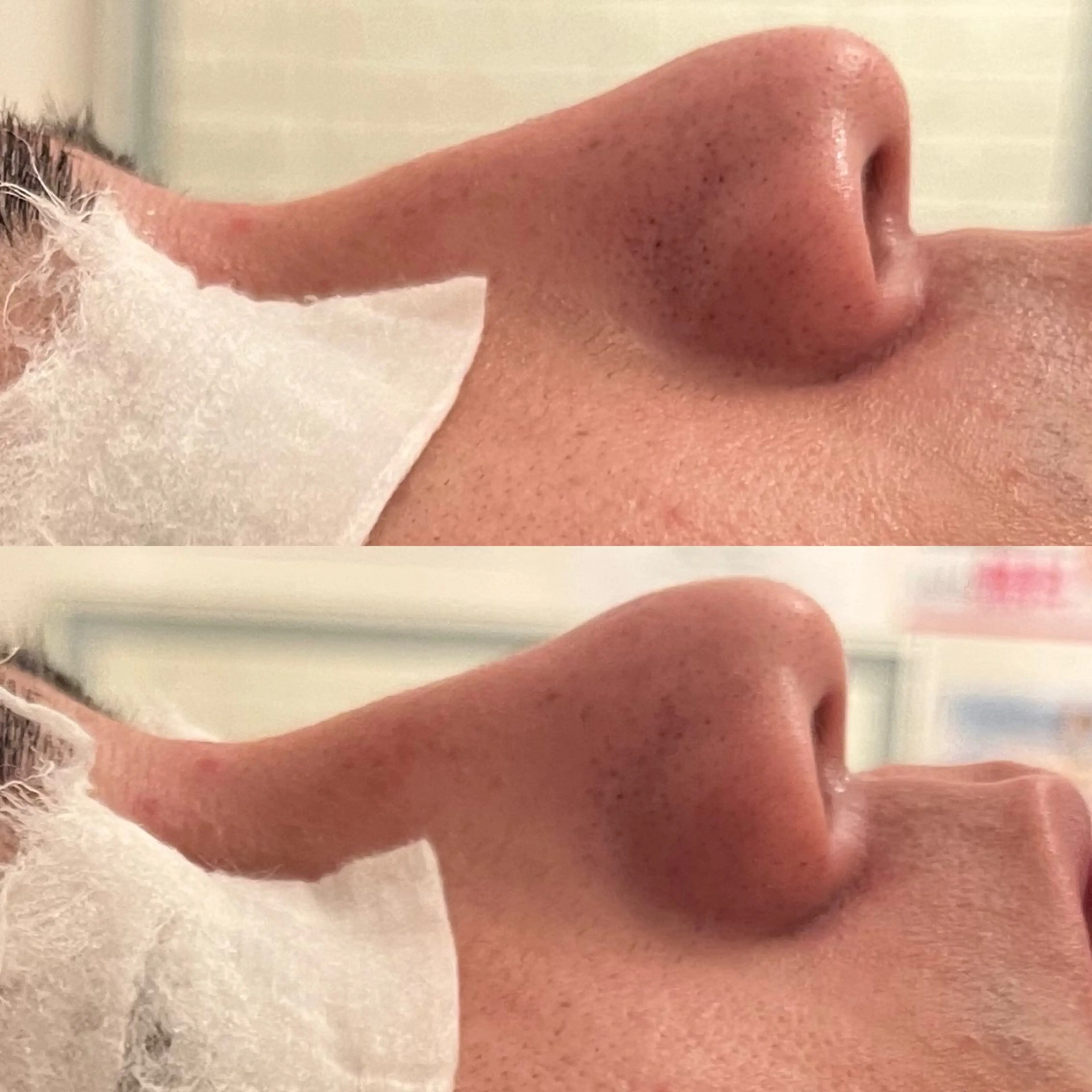 メンズ 毛穴ケア/毛穴診断/ 毛穴洗浄〔心斎橋〕のエステ・リラクイメージ