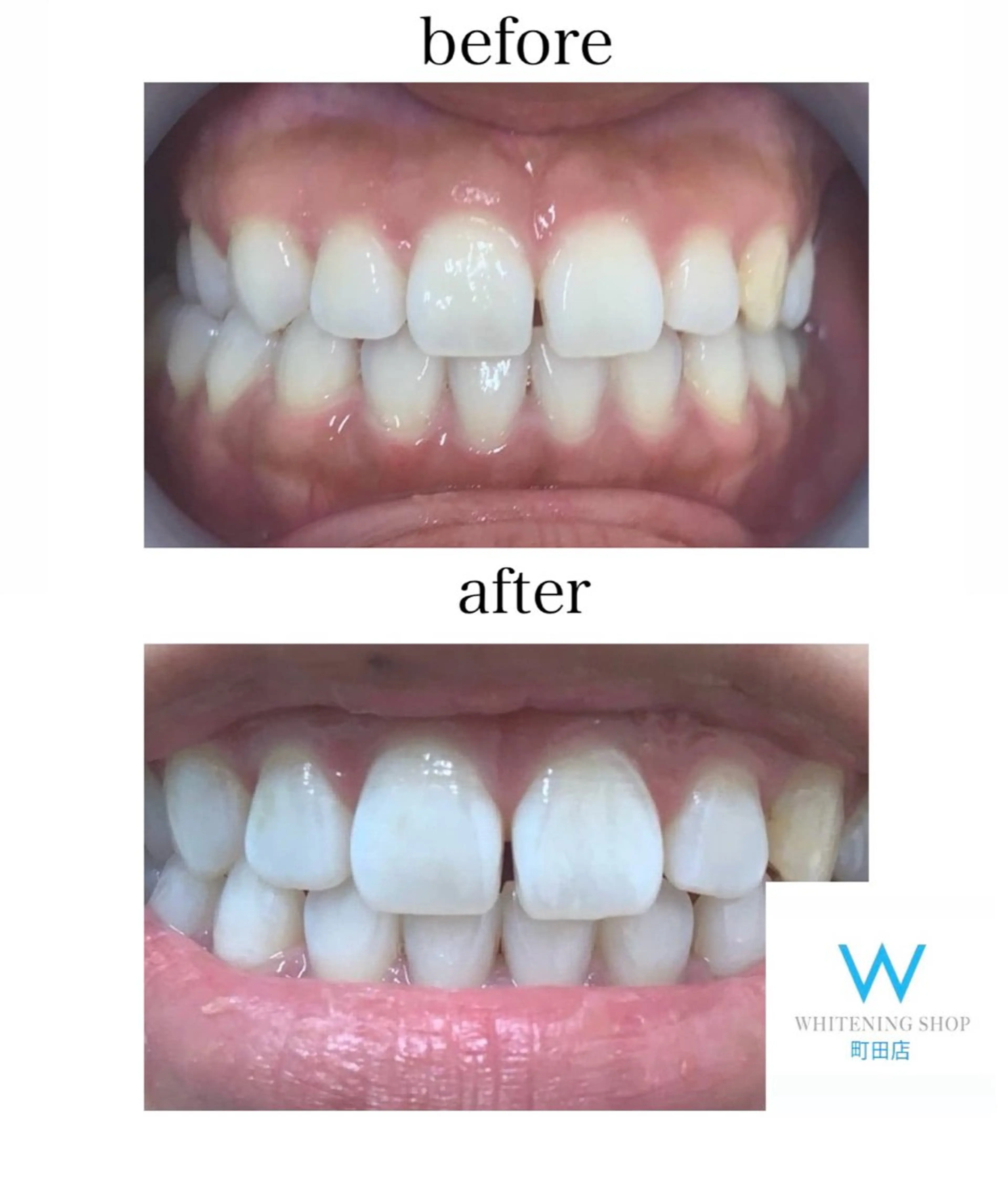 メンズ キッズ その他 ホワイトニング ショップ町田店のその他イメージ