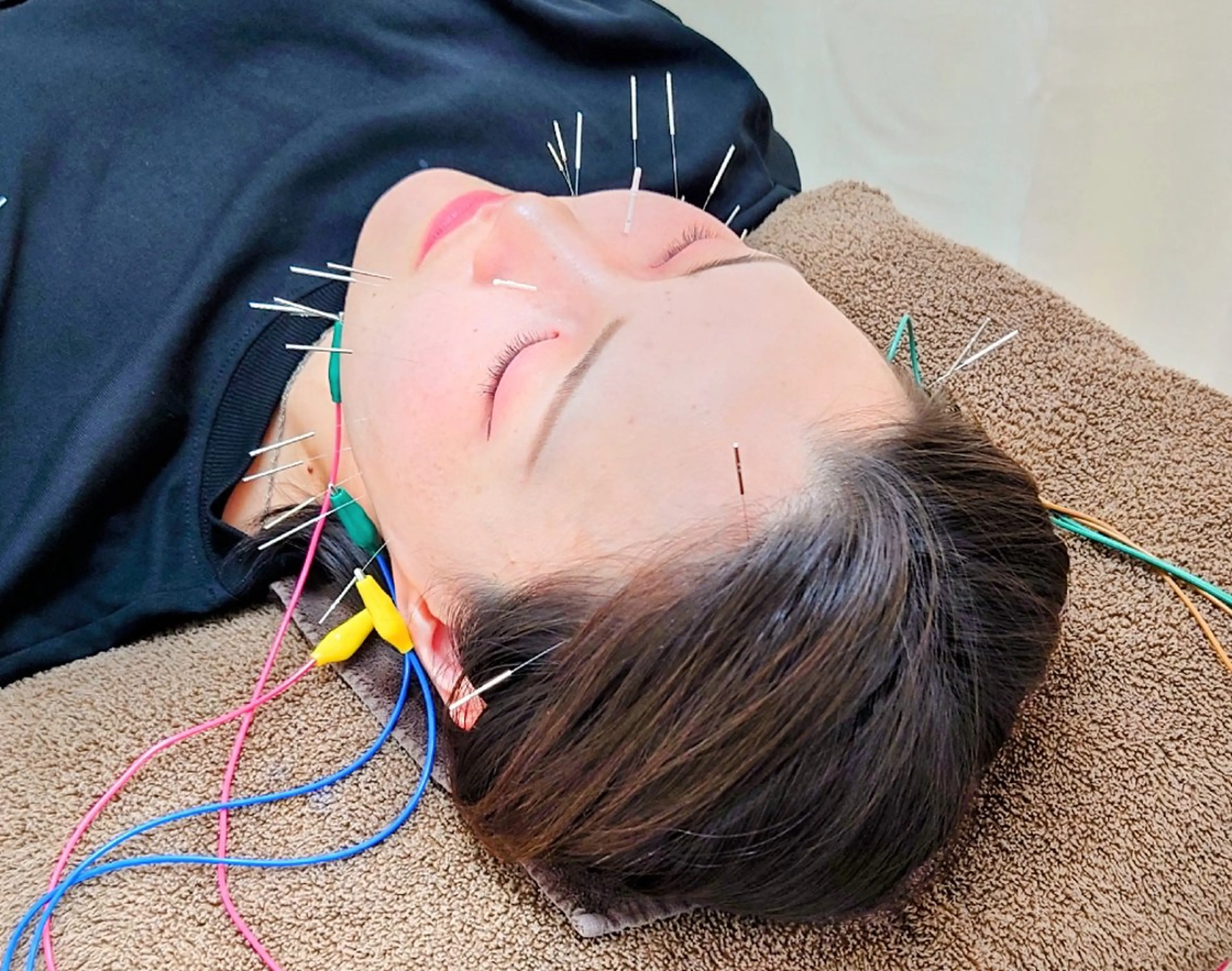 スカイブルー 鍼灸接骨院　佐々木のエステ・リラクイメージ