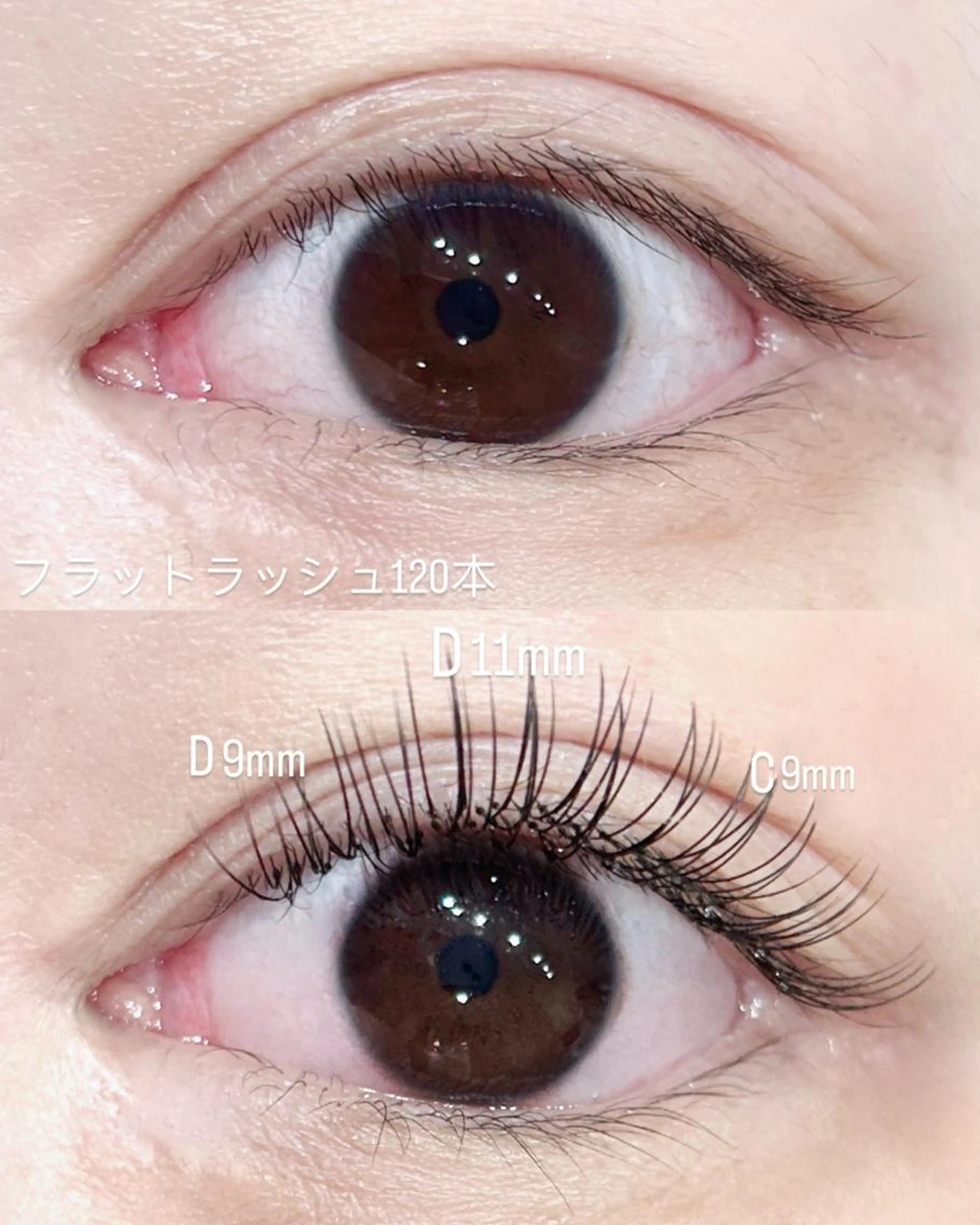 フラットラッシュ100本の写真