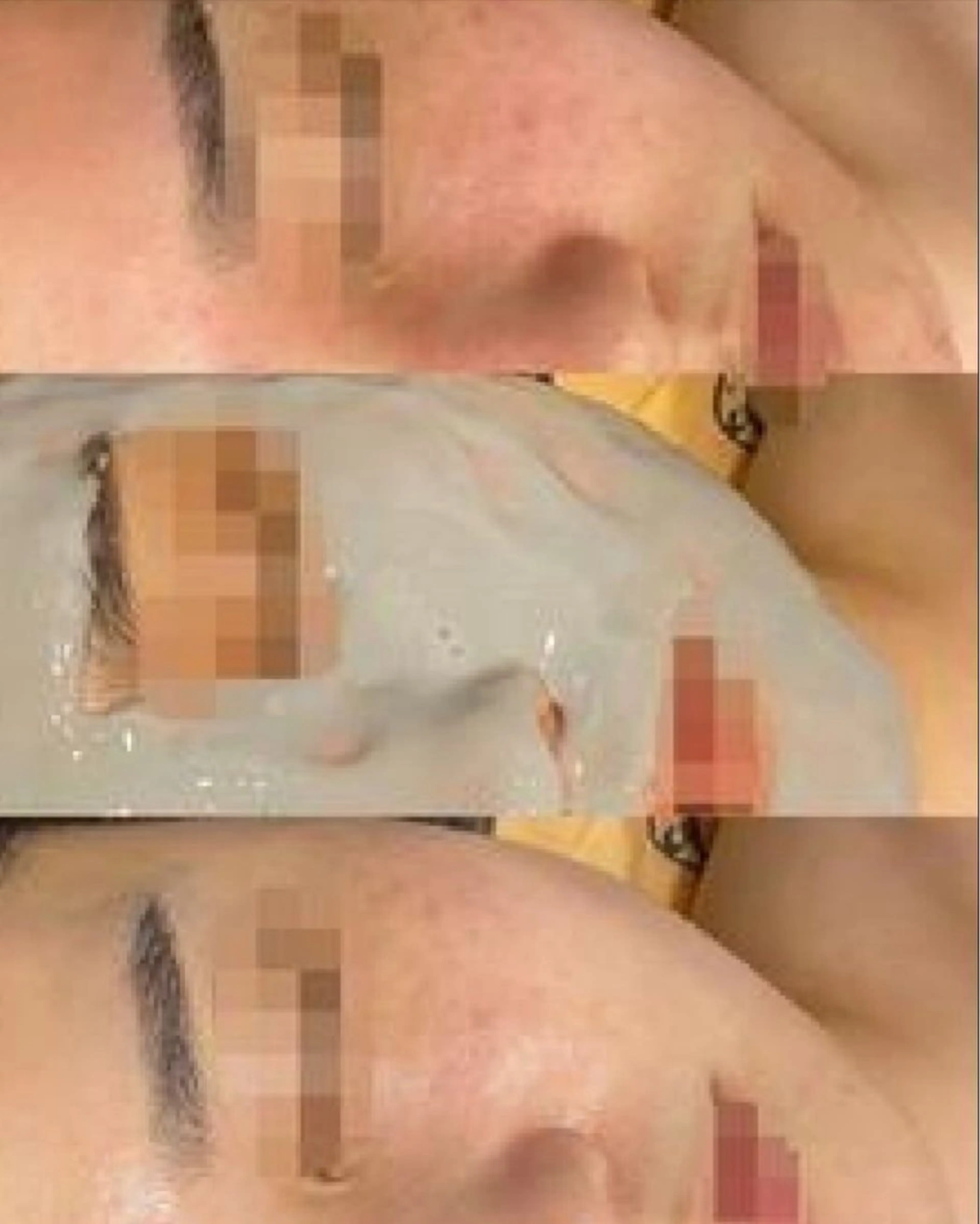 《初回限定》韓国発！SJ究極の美肌トリートメント＋小顔ケア　白玉肌へ《年齢肌/くすみ》　100分の写真