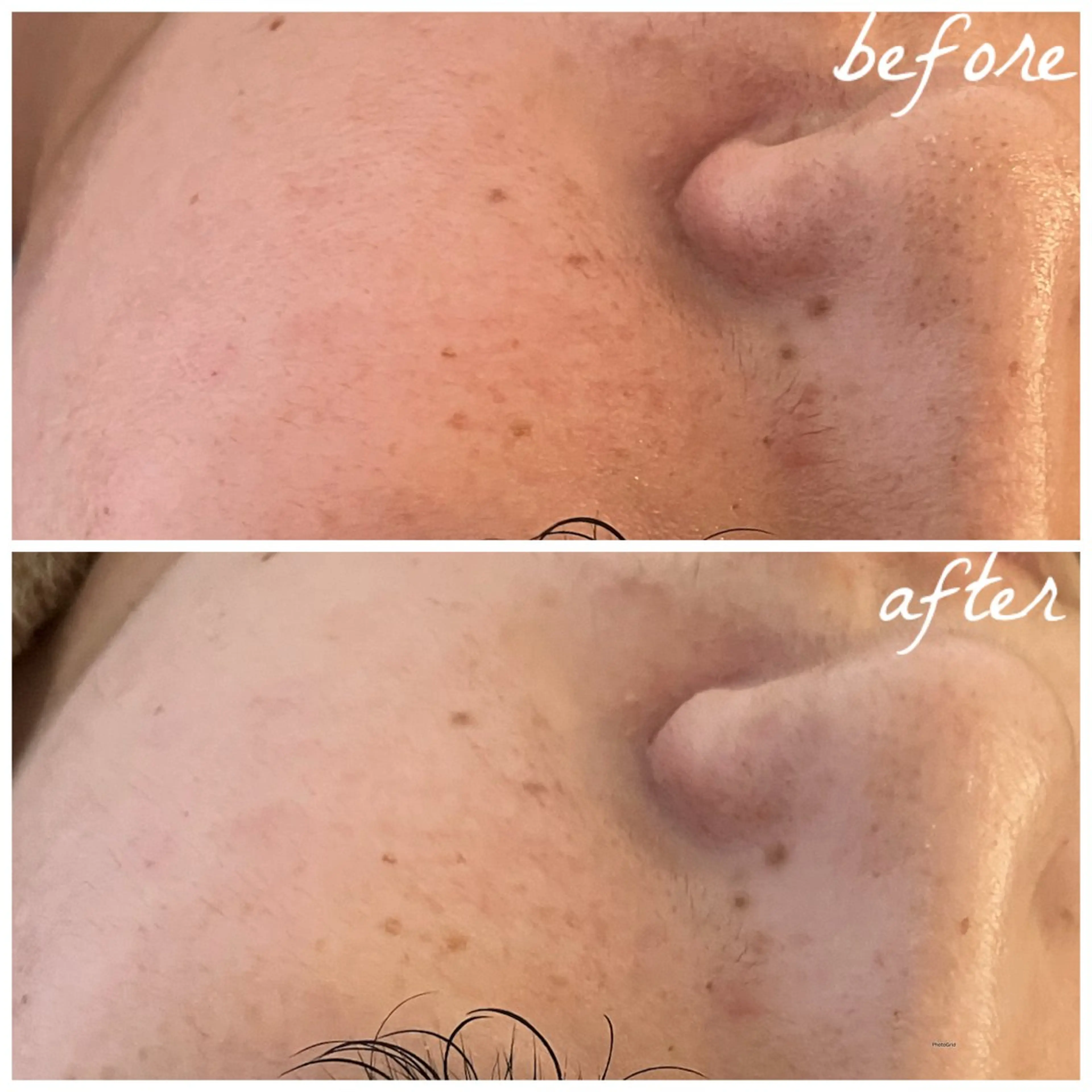 メンズ エステ メナード岐阜茜部 杉浦のエステ・リラクイメージ