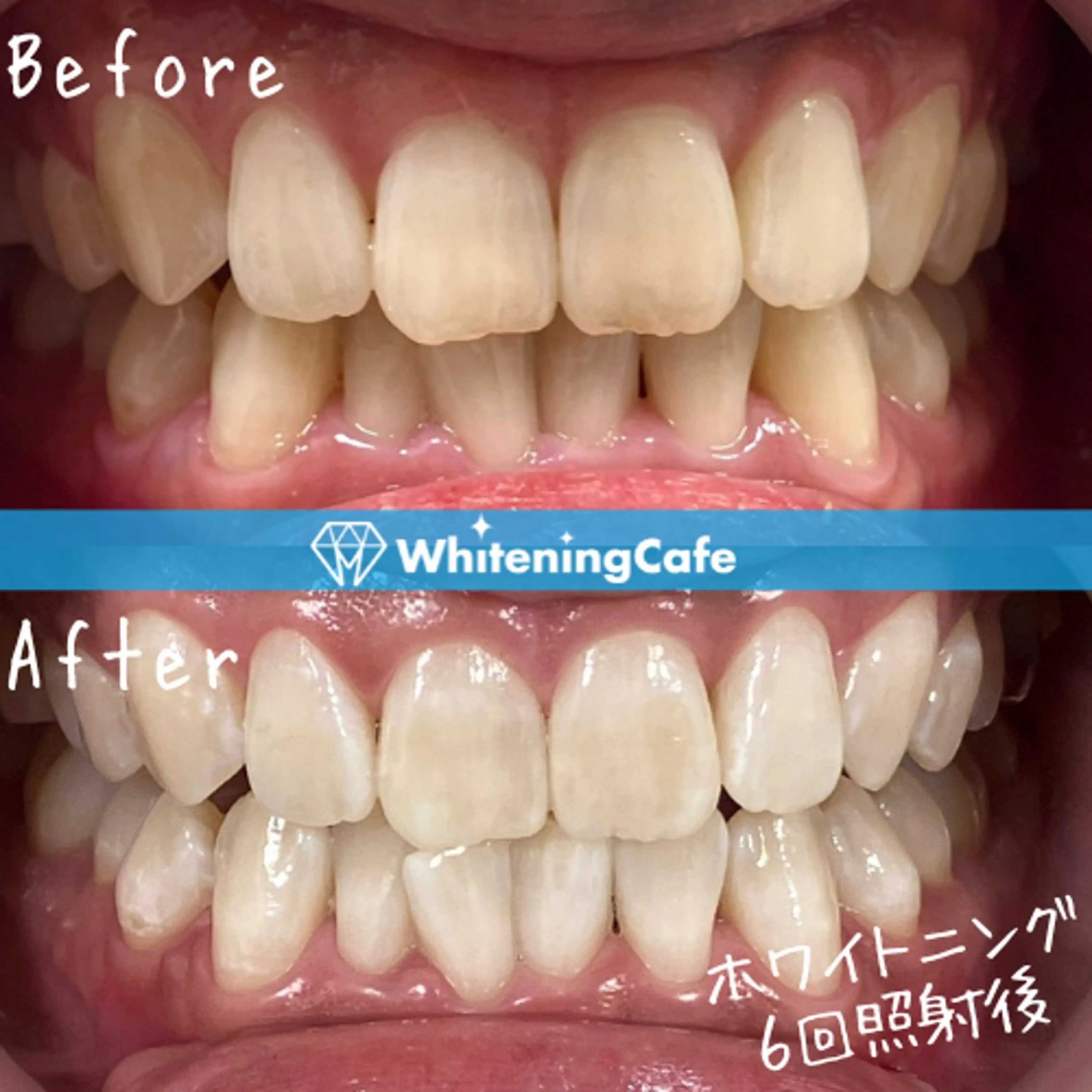 ホワイトニングカフェ徳島沖浜店所属・ホワイトニングカフェ 徳島沖浜店のエステ・リラクイメージ