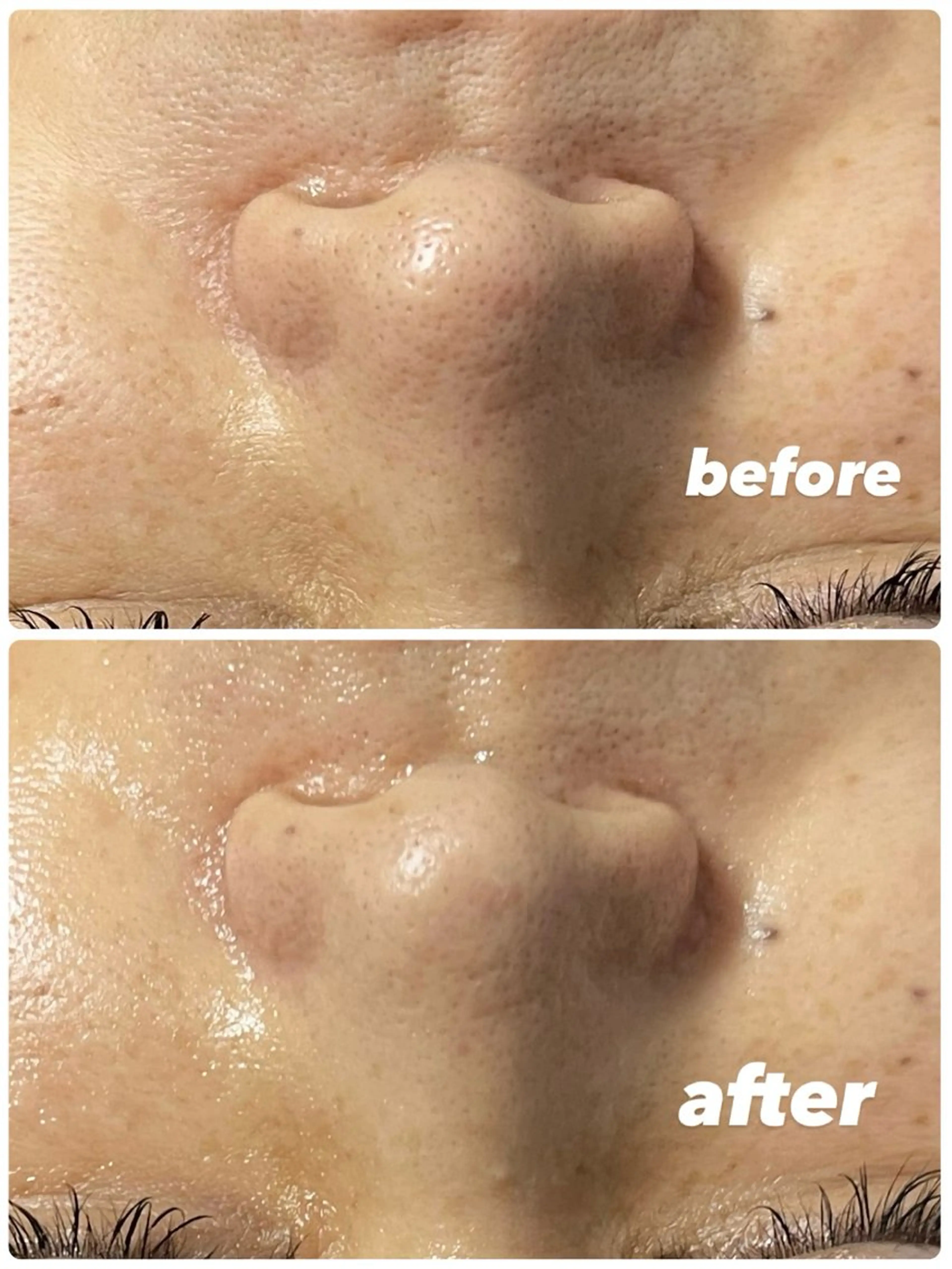 エステ blue.【都度払い脱毛&フェイシャルサロン】所属・blue.💙【 脱毛&フェイシャル】のエステ・リラクイメージ