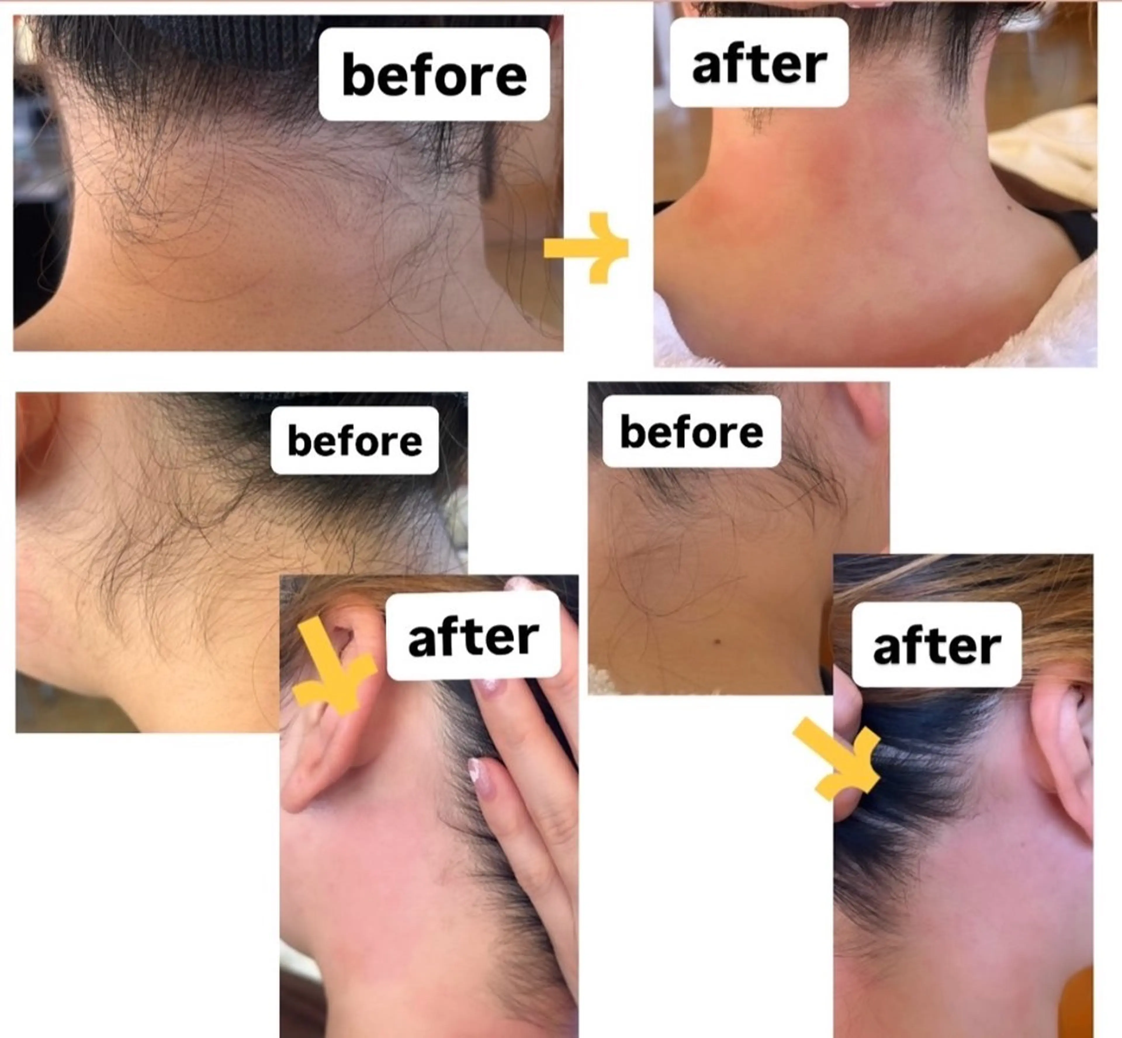 うなじWaxの写真