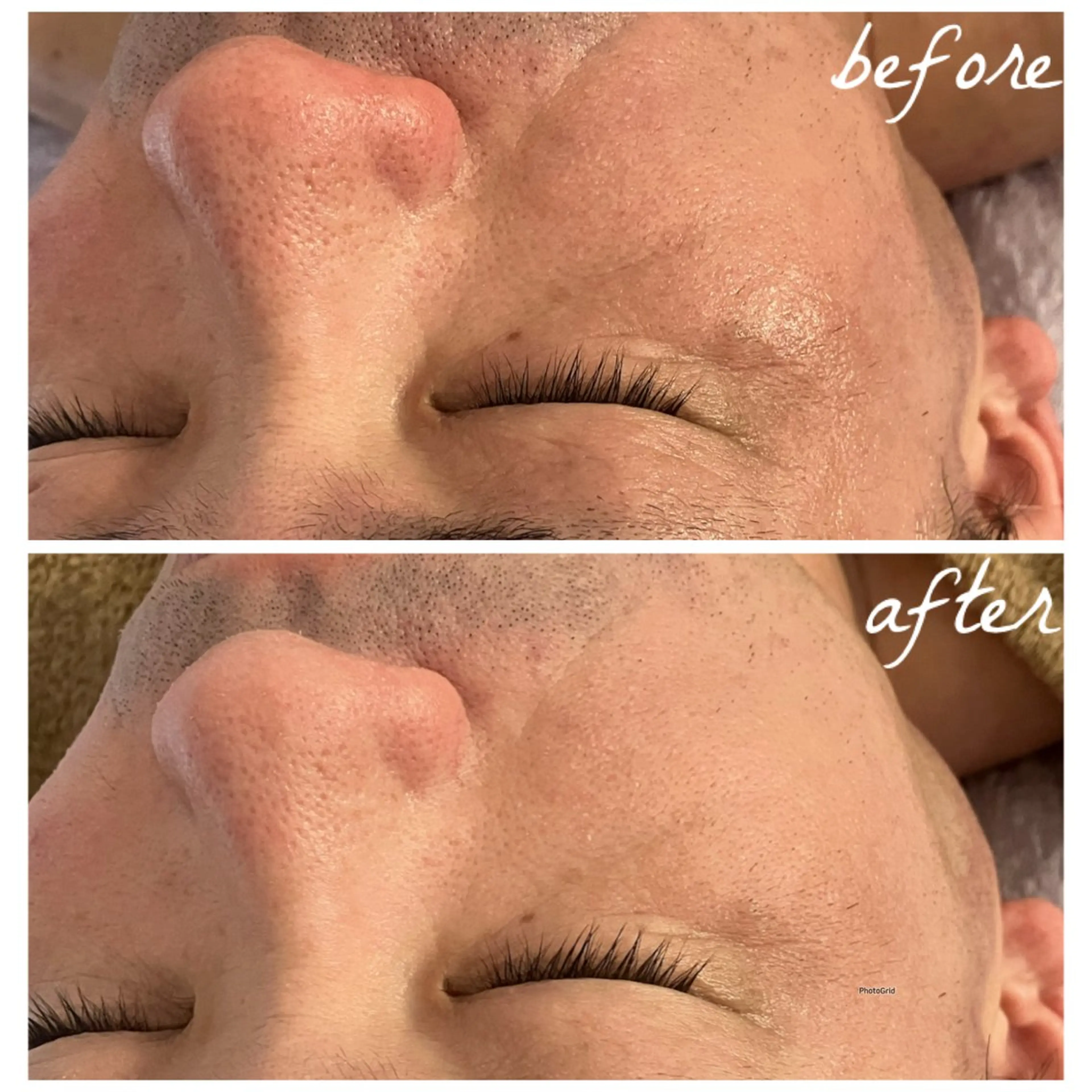 メンズ エステ メナード岐阜茜部 杉浦のエステ・リラクイメージ