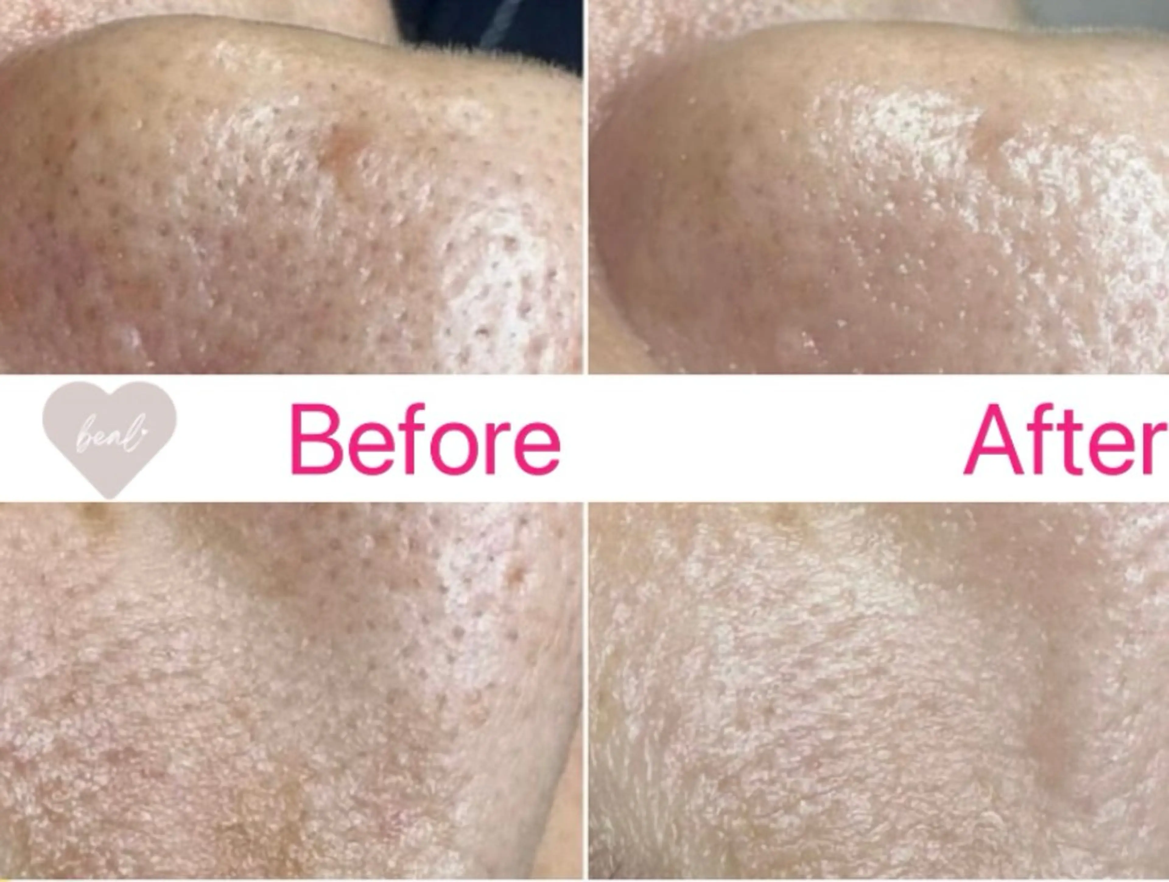 エステ べアール所属・小顔/毛穴/ニキビ salon bealのエステ・リラクイメージ