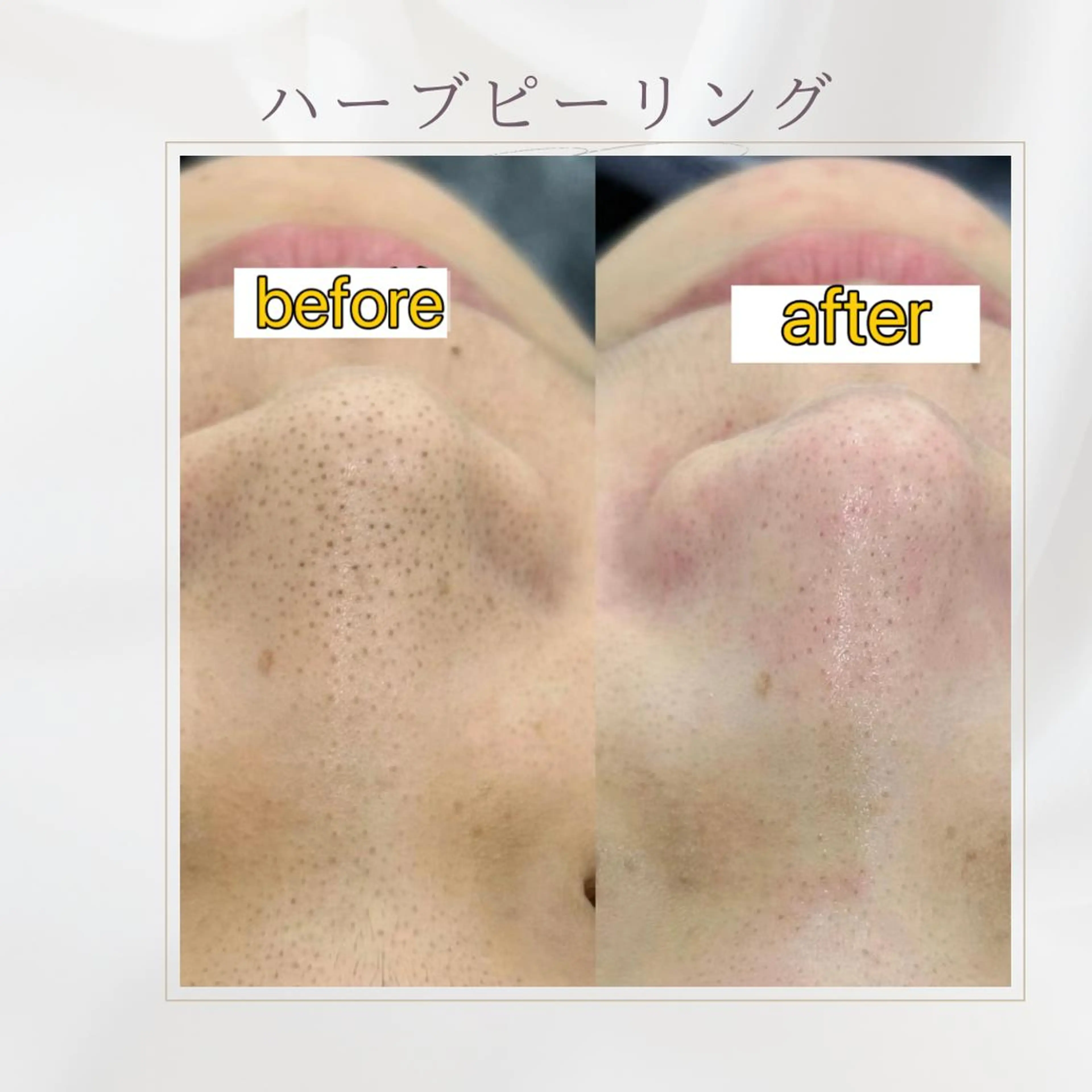 西区九条エステ MITUREIサロンのエステ・リラクイメージ