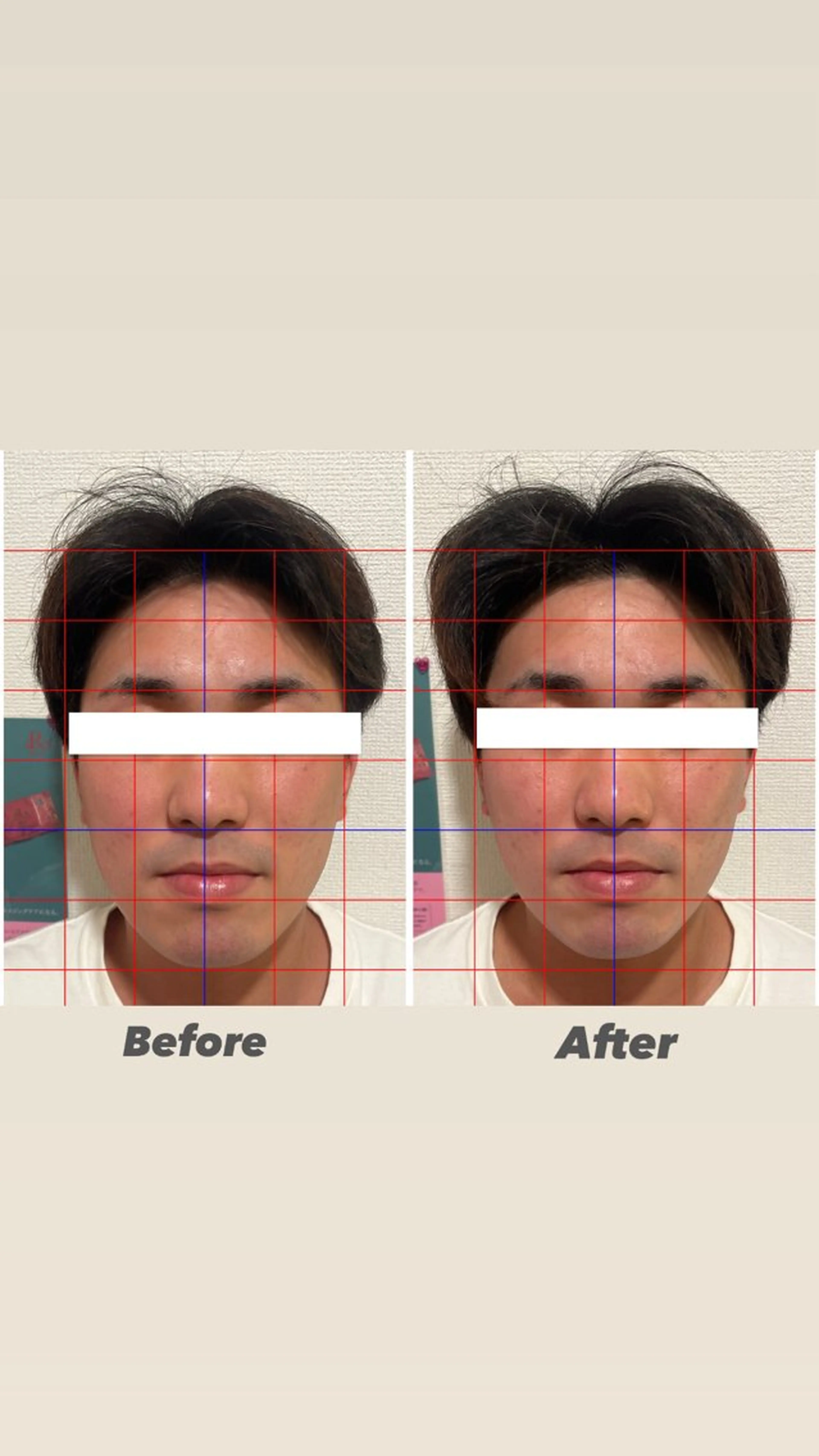 コルギ&炭酸ヘッドマッサージの写真