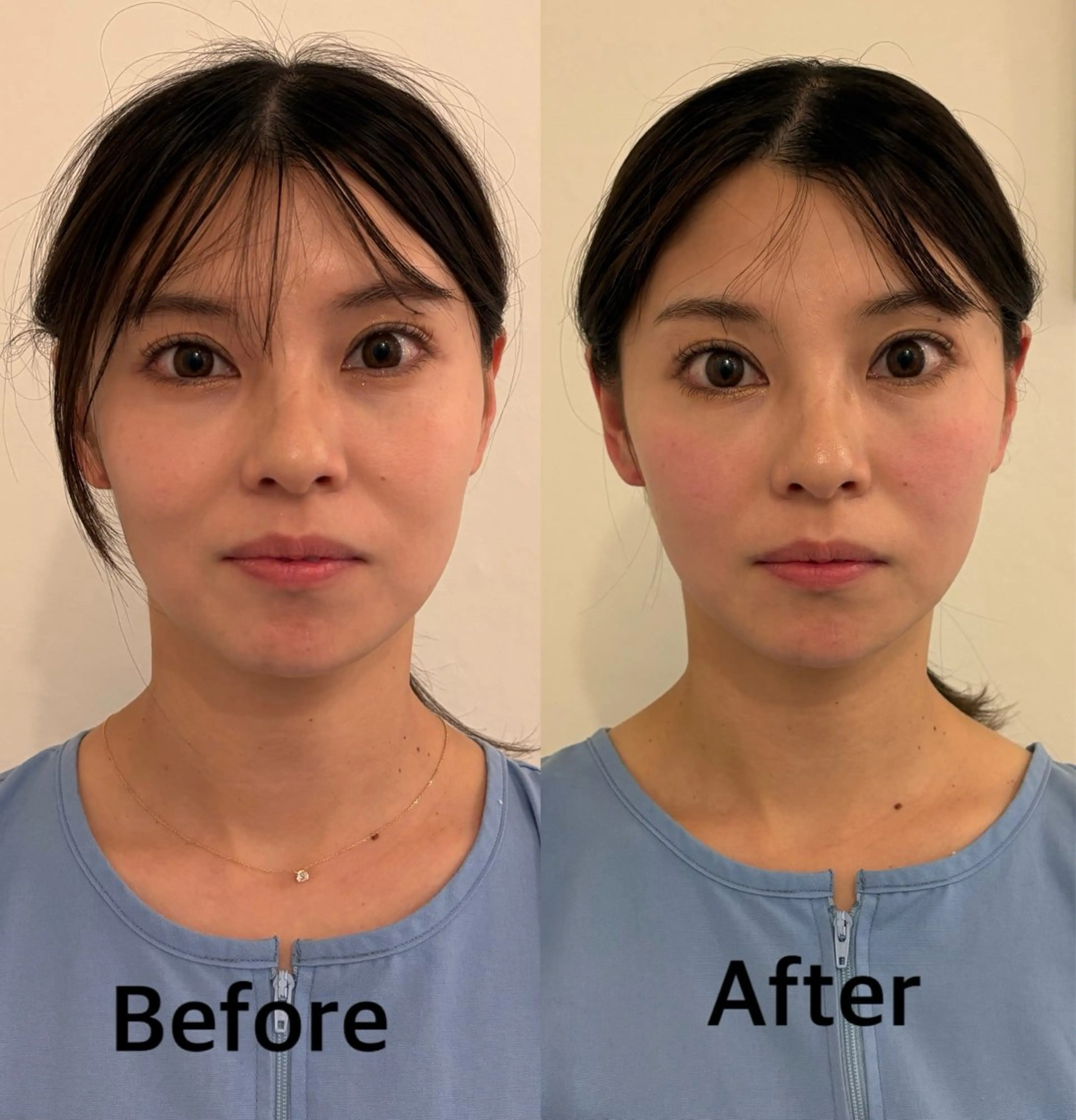 鍼灸サロン mahorobaトモのエステ・リラクイメージ