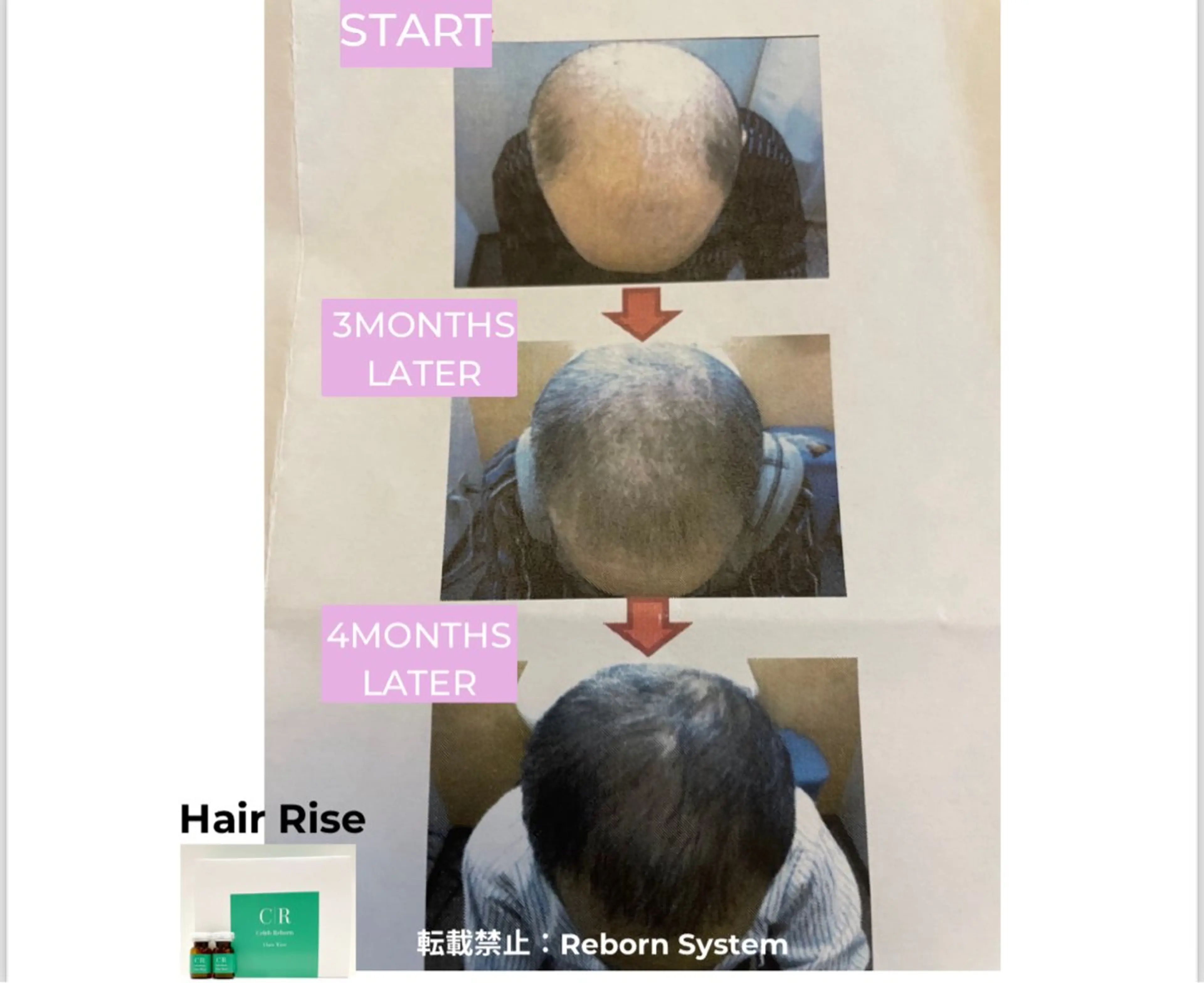 【福岡市西区 エステ】 GRANVIR(グランヴィール)所属・GRANVIR グランヴィールのエステ・リラクイメージ