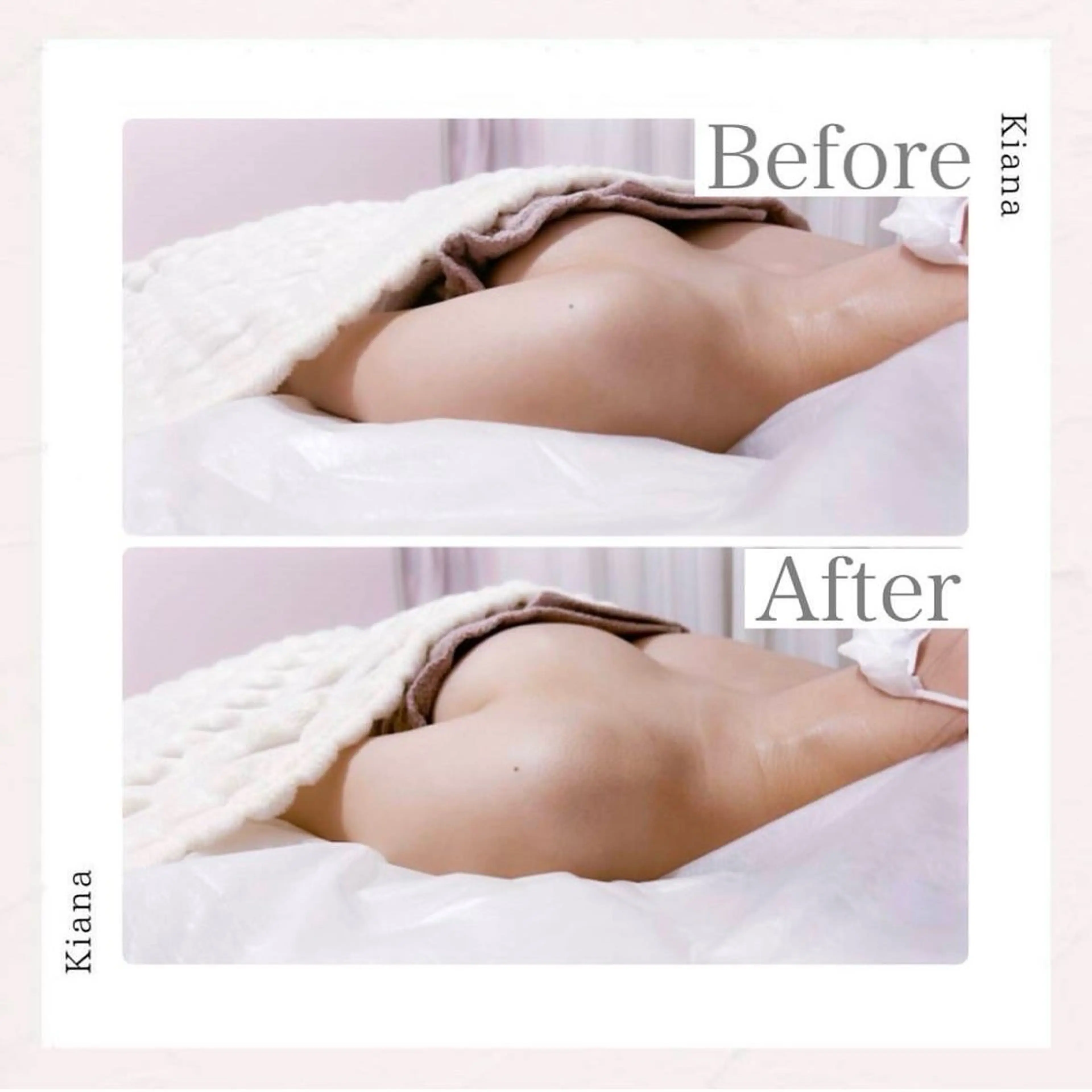 エステ リラク バスト専門Kiana 風のエステ・リラクイメージ