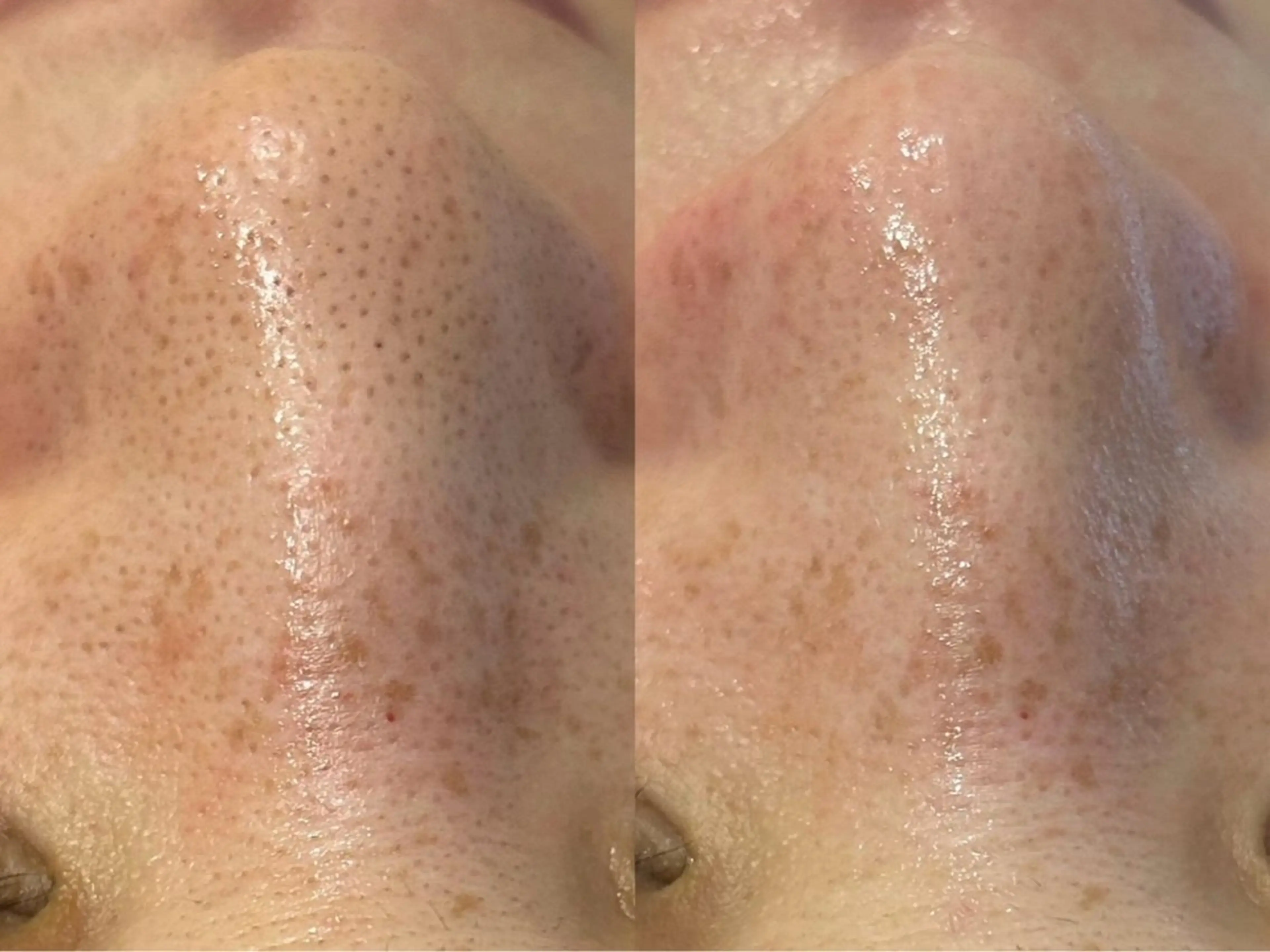 【都度払い脱毛 美肌脱毛】馬車道店のエステ・リラクイメージ