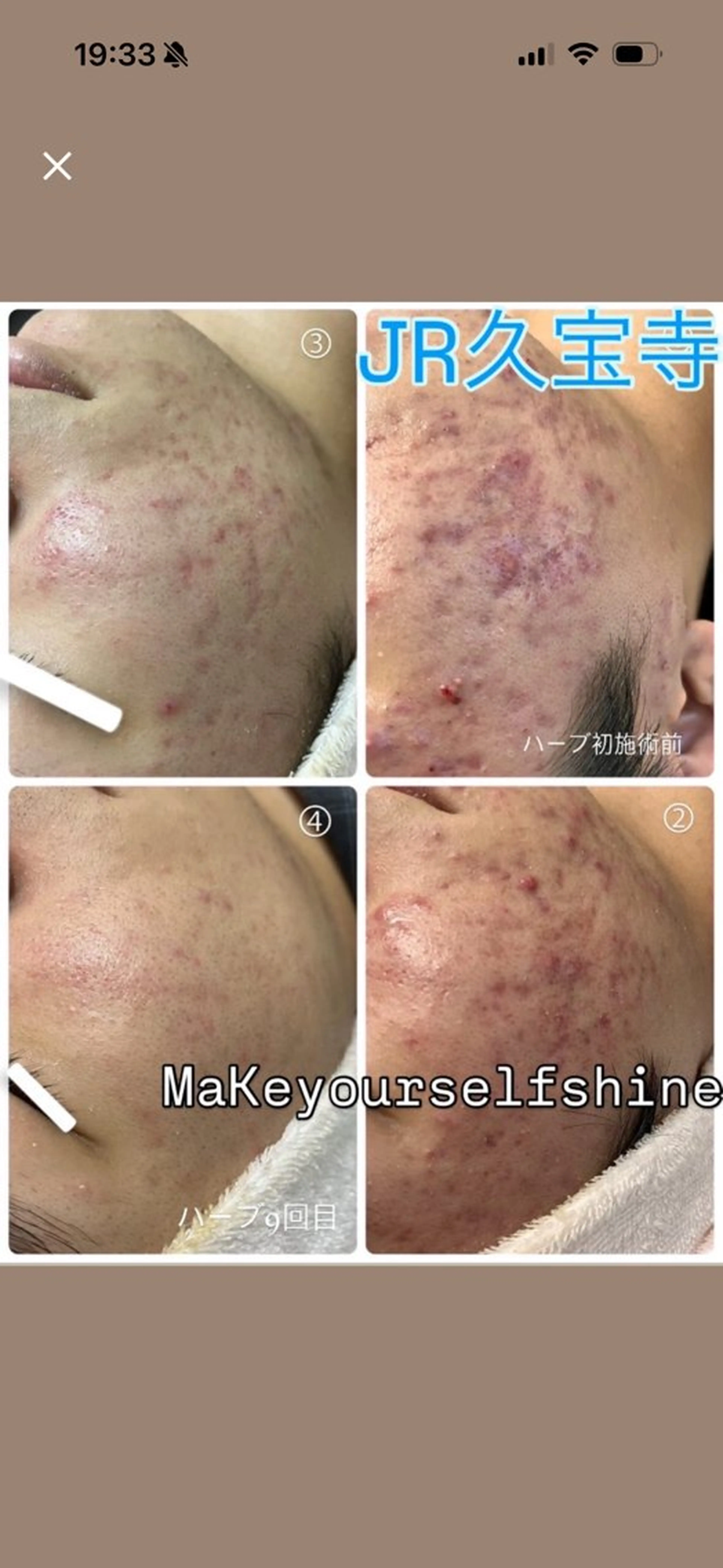 エステ リラク まいまい／八尾／JR 久宝寺／サロンのエステ・リラクイメージ