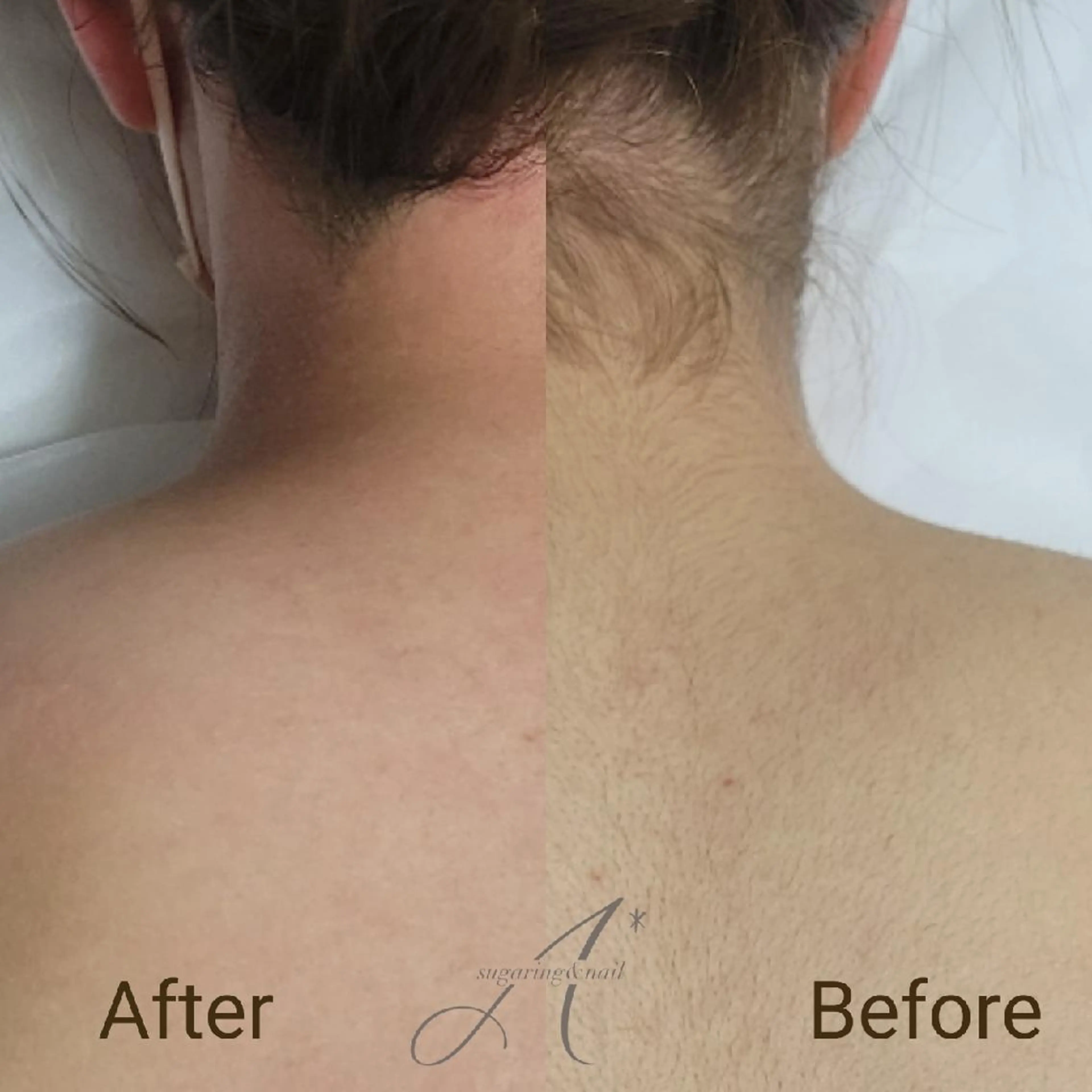 A*[エースター] シュガーリング🍋のエステ・リラクイメージ