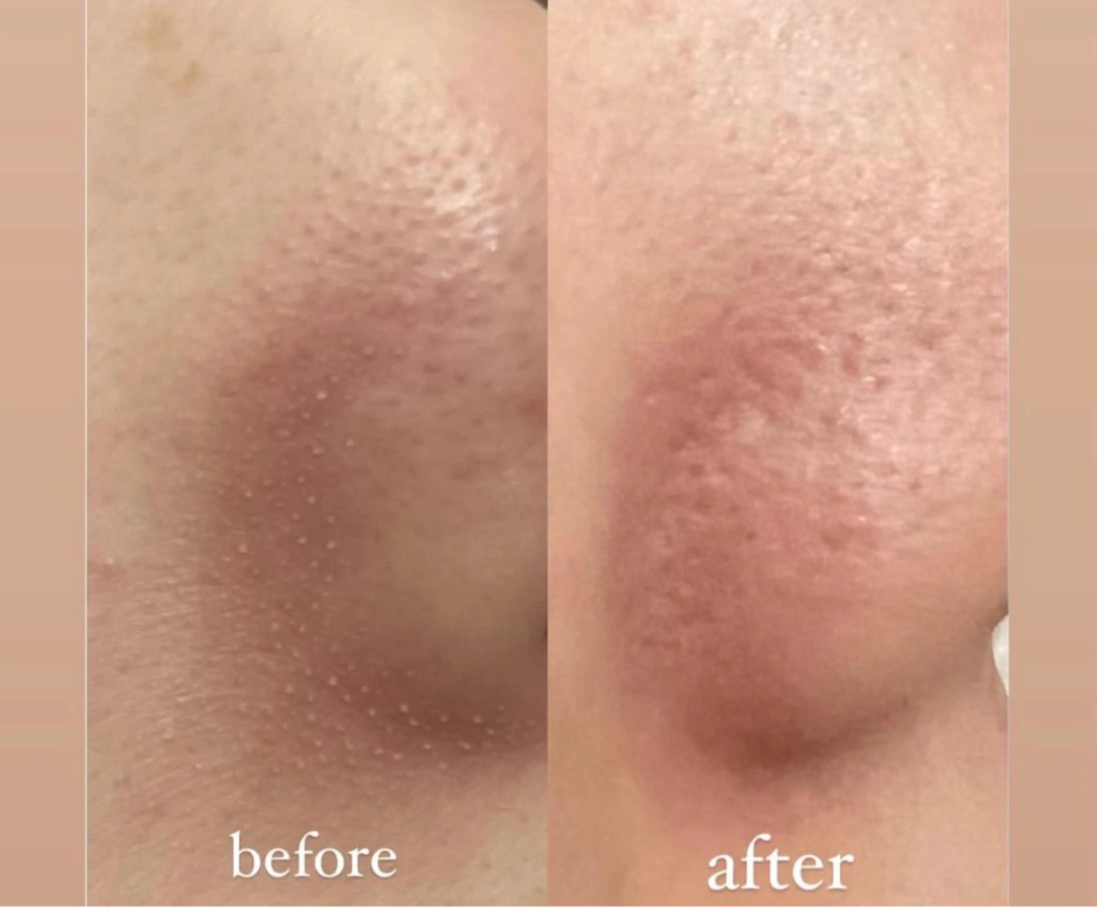 ナリス ビューティーステーション デ・アイム 有田所属・西谷 ゆめのエステ・リラクイメージ