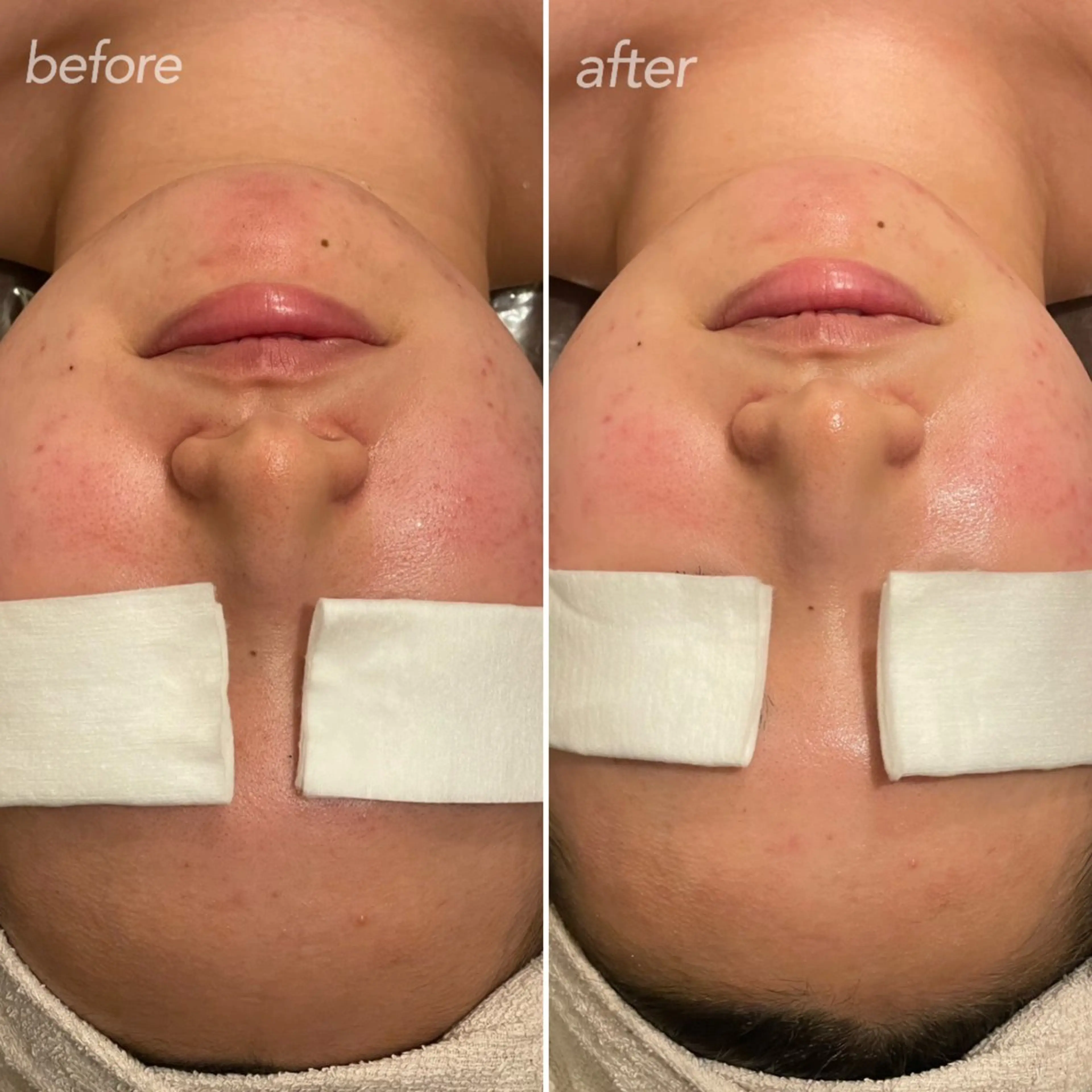 エステ 越野 Tulipe栄店のエステ・リラクイメージ