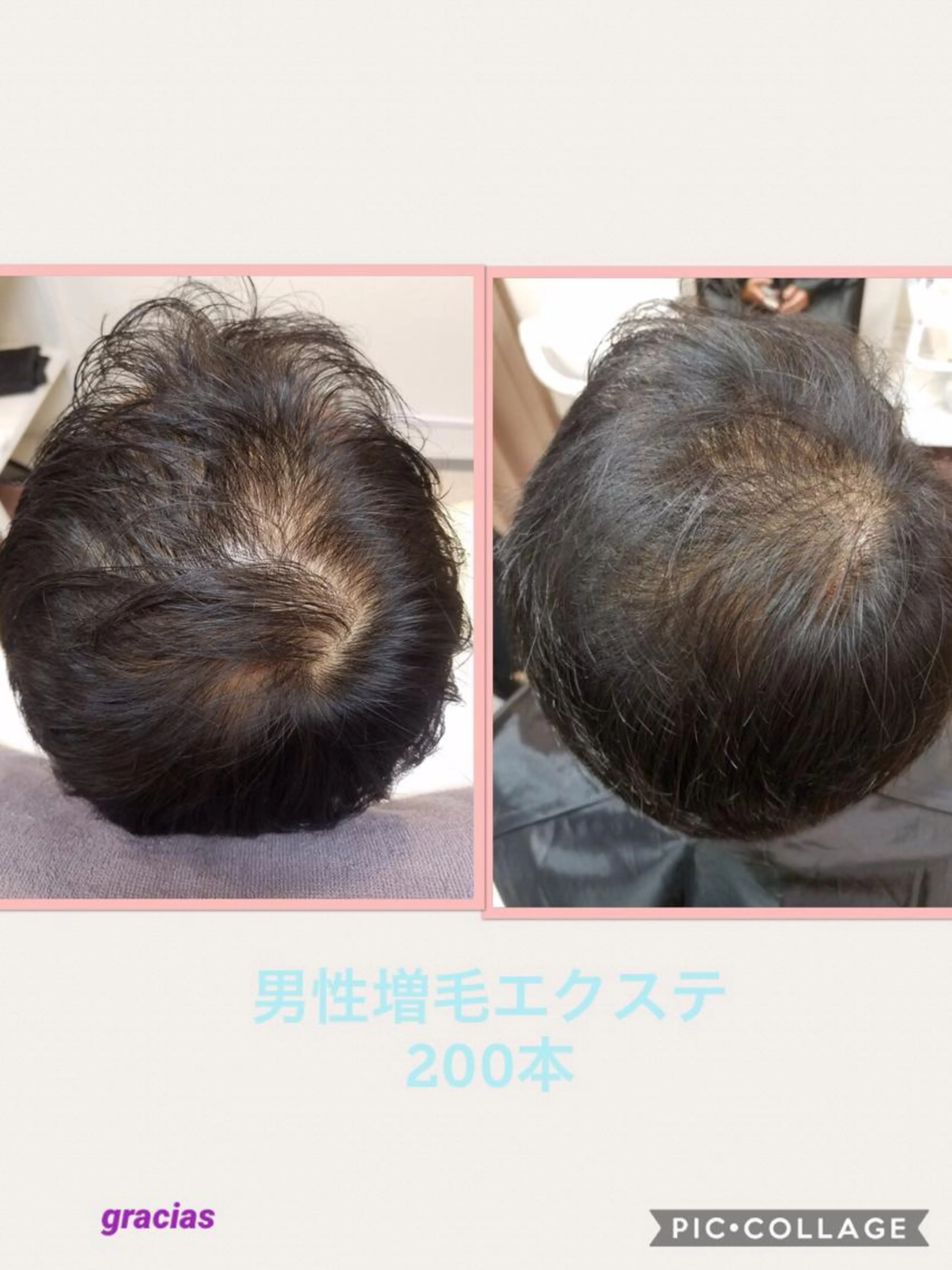 増毛エクステ200本の写真