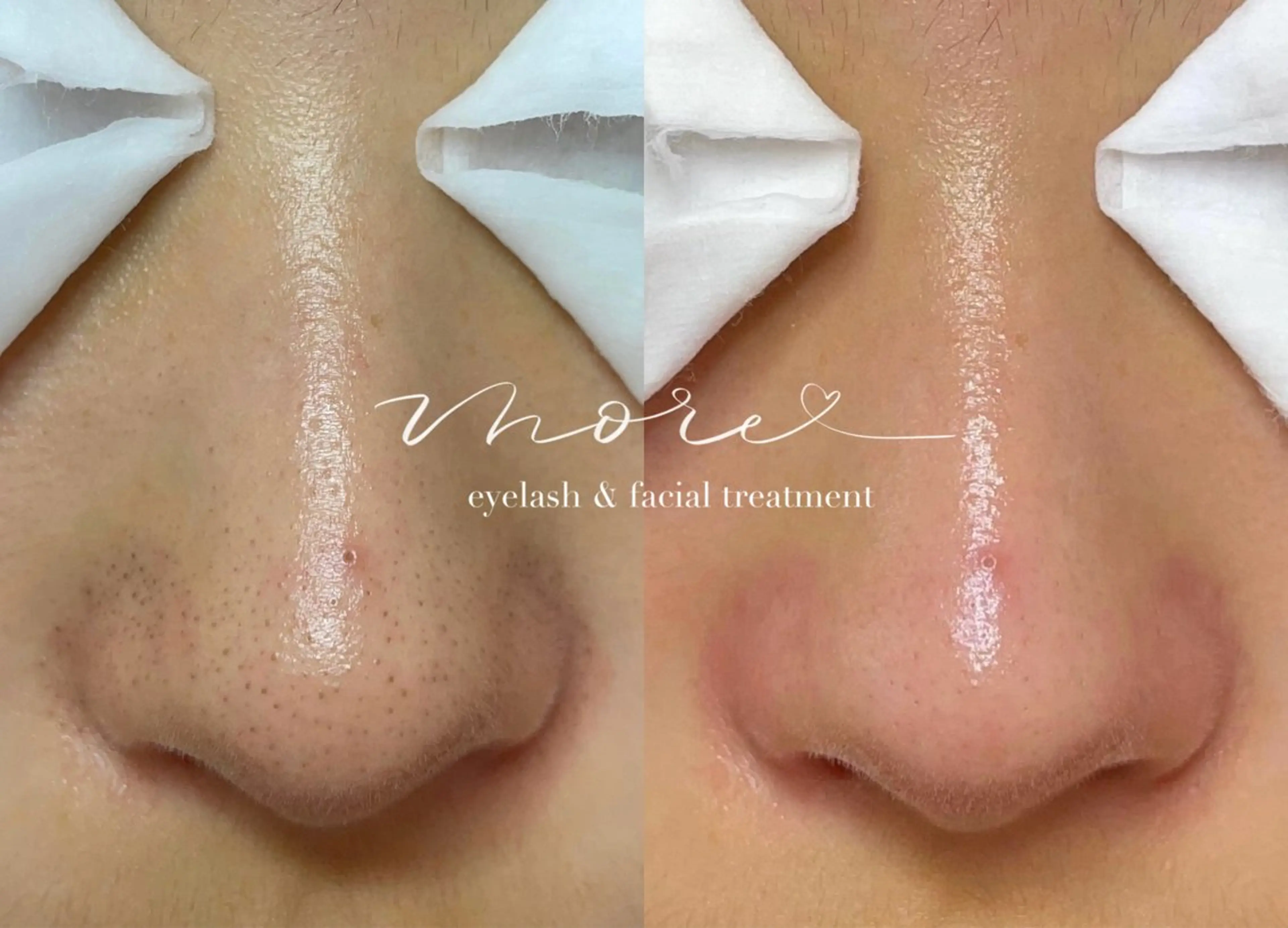 Eyelash salon MORE(モア)所属・安納 麻穂のエステ・リラクイメージ