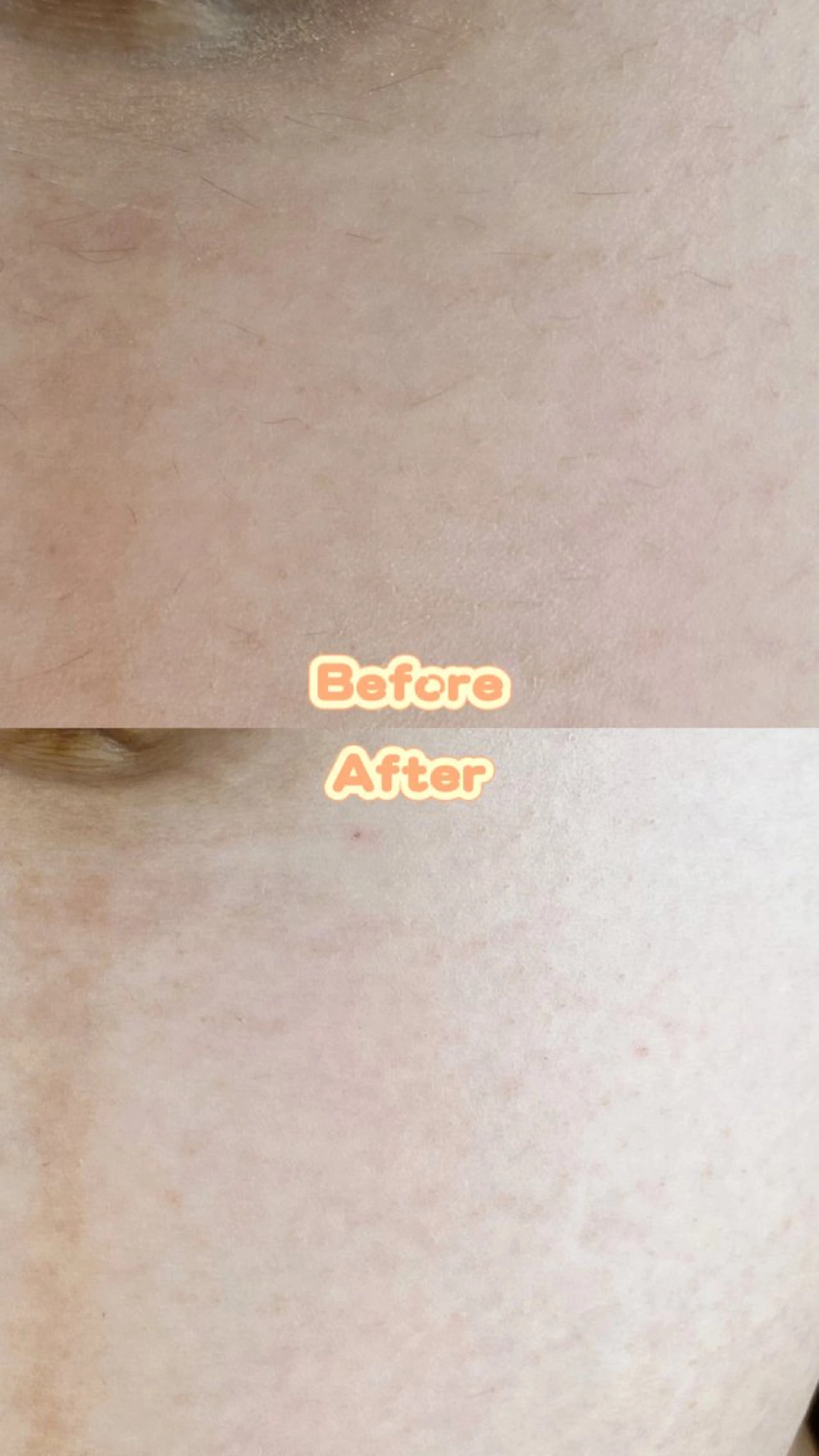 Hit. シュガーリング豊橋のエステ・リラクイメージ