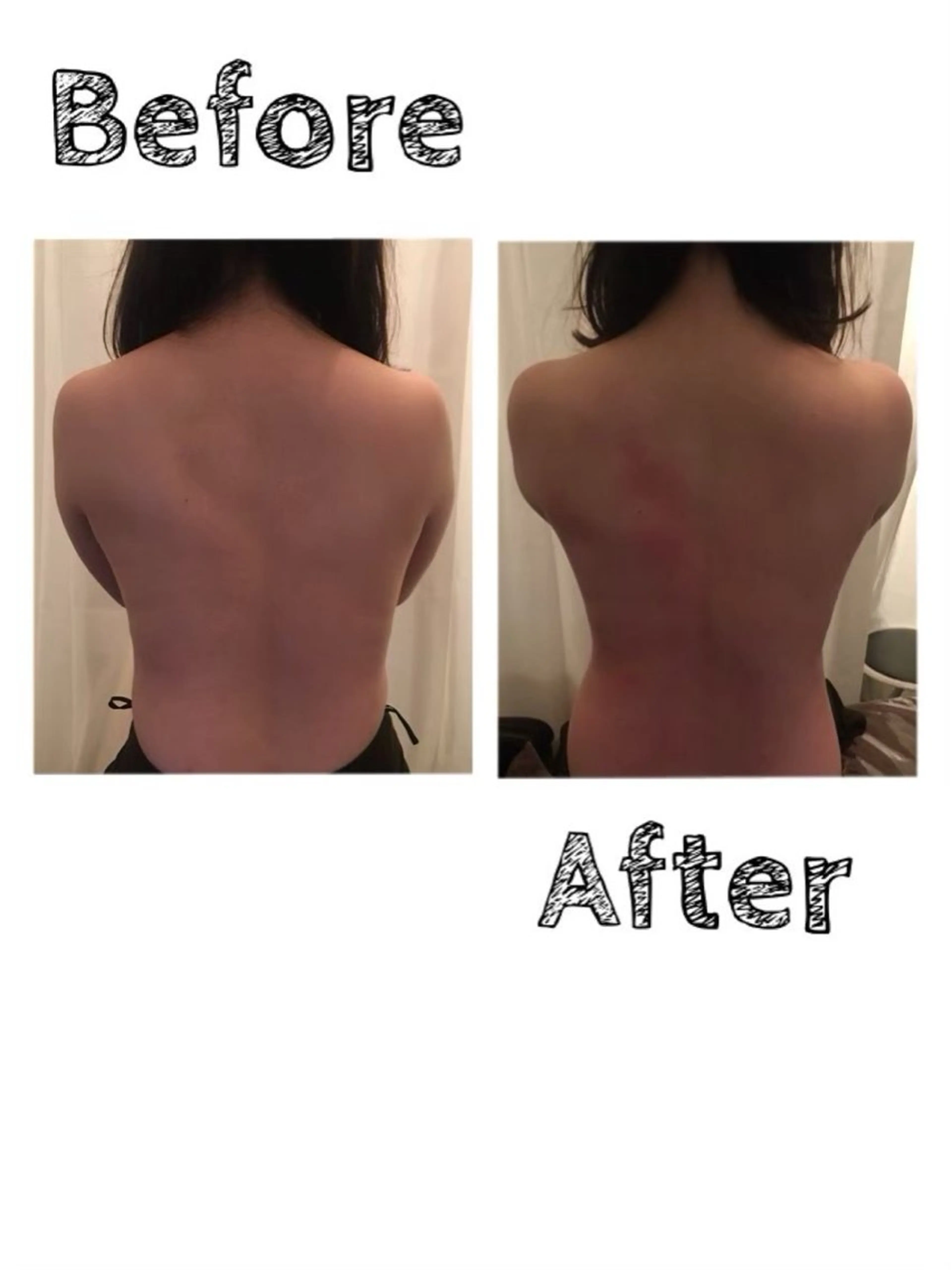 夏までに！ -5kgチャレンジのエステ・リラクイメージ