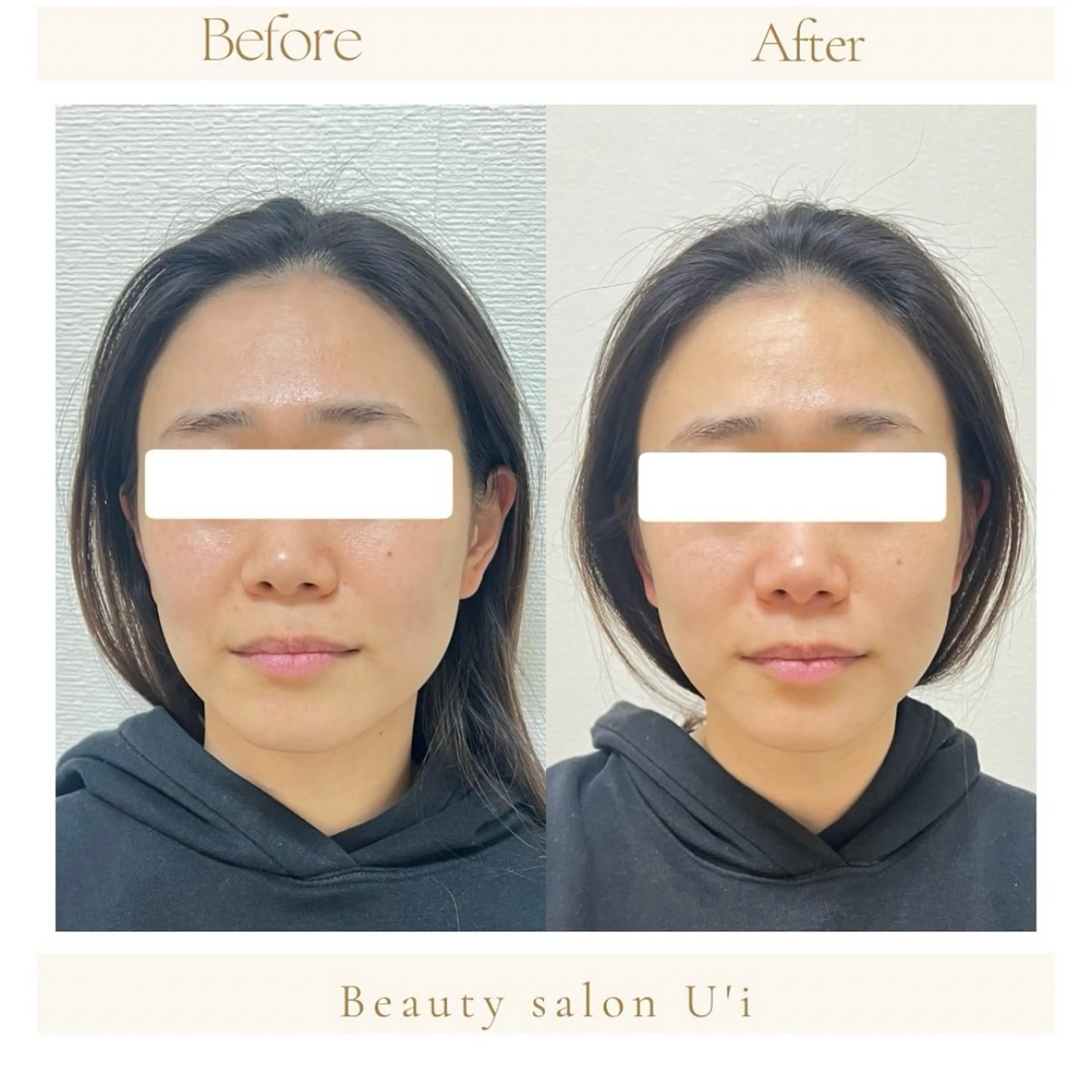 頭蓋骨小顔矯正 藤本のエステ・リラクイメージ