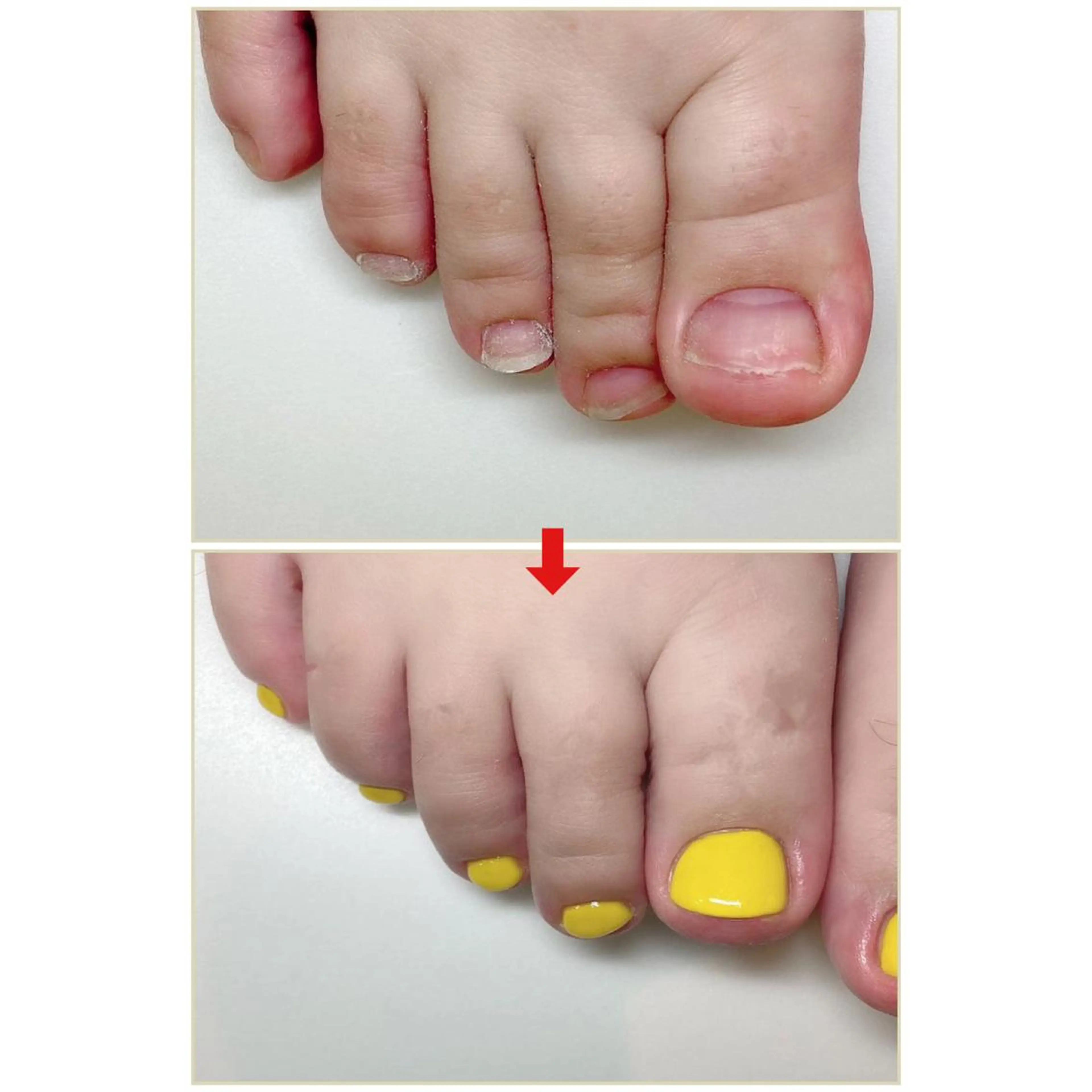 ネイル フットネイル ネイルサロンアリューム所属・ネイルサロン アリュームのネイルデザイン