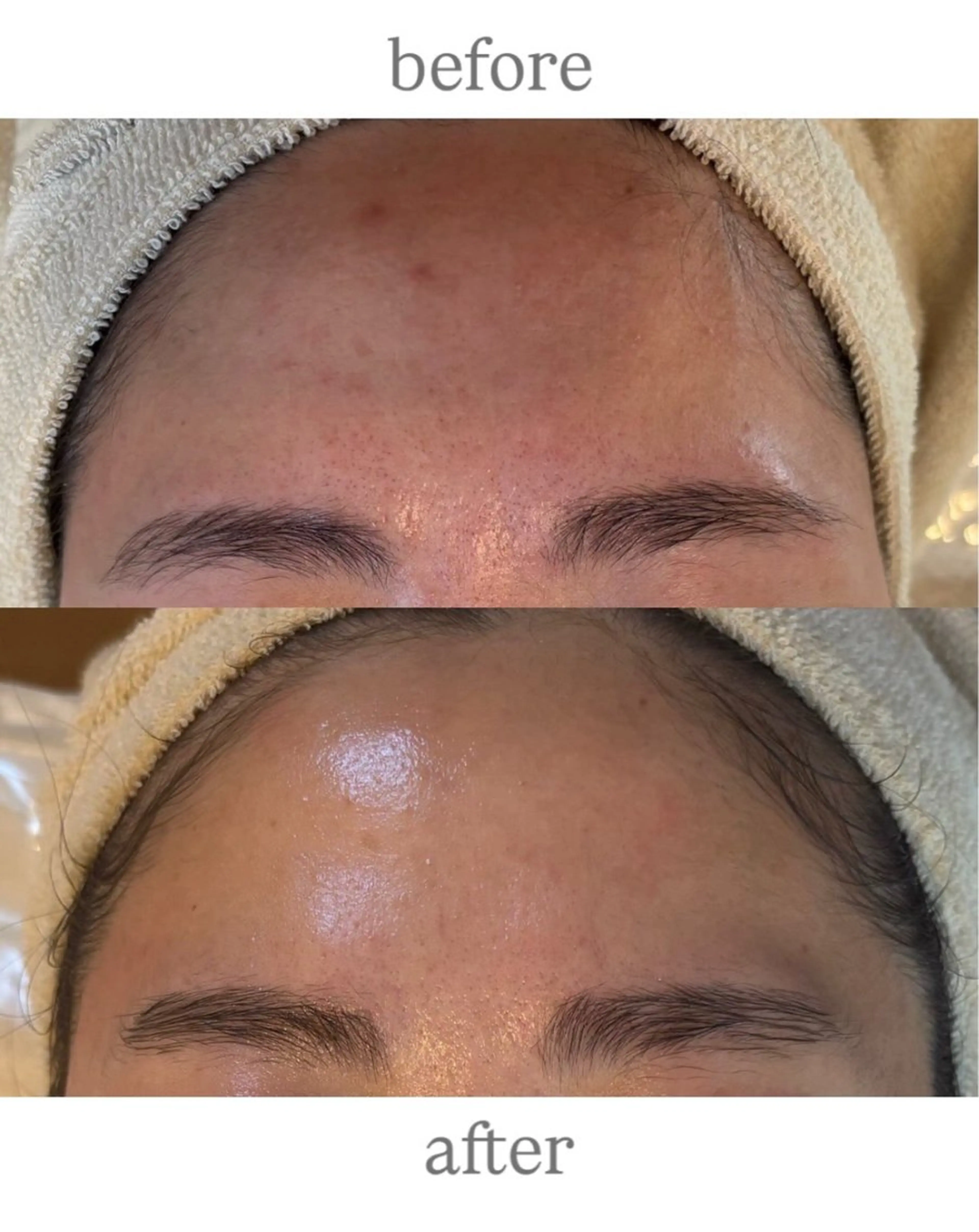 エステ anthes /MIHOのエステ・リラクイメージ