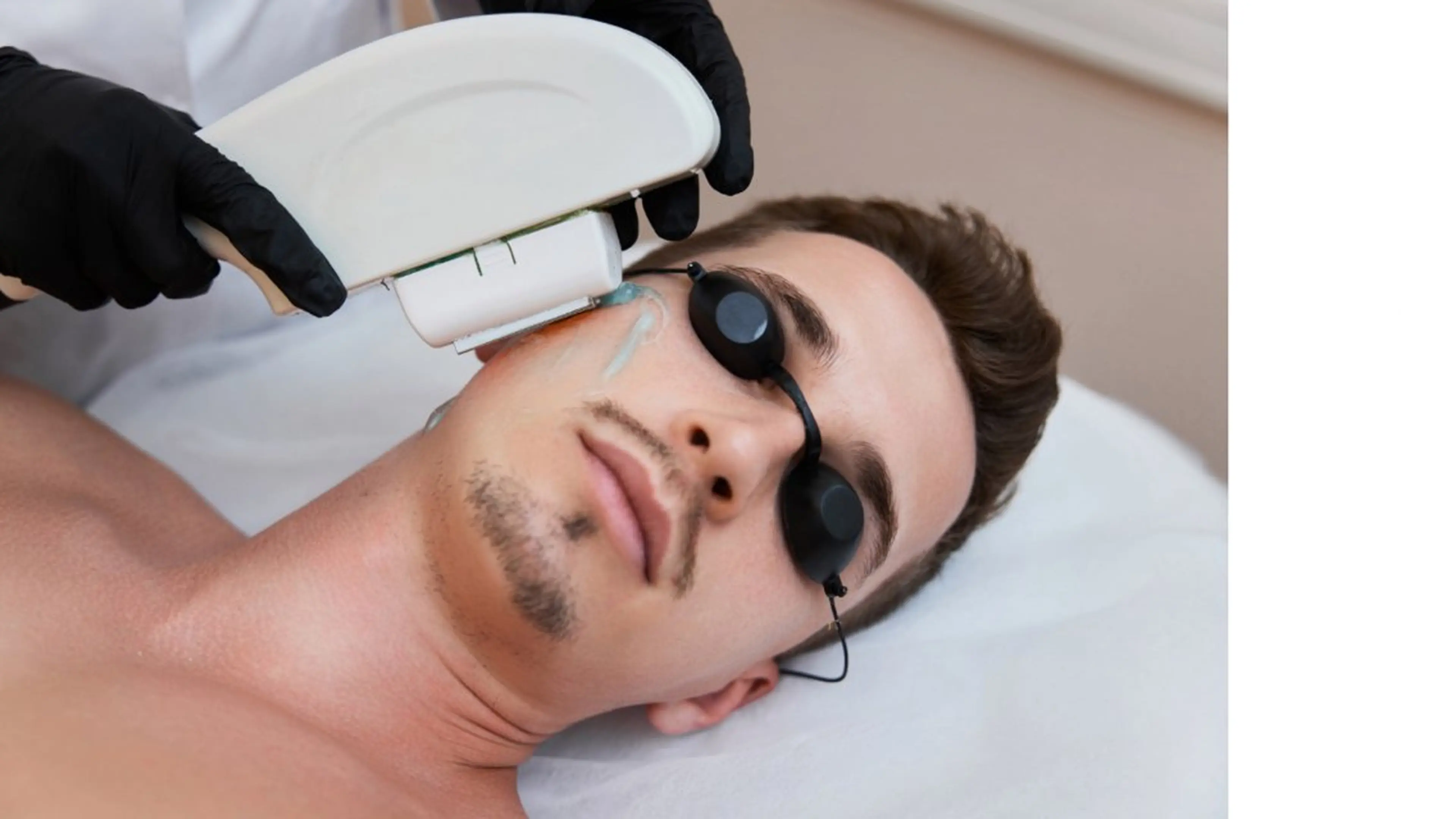 メンズ　髭脱毛　初回20%OFF!の写真