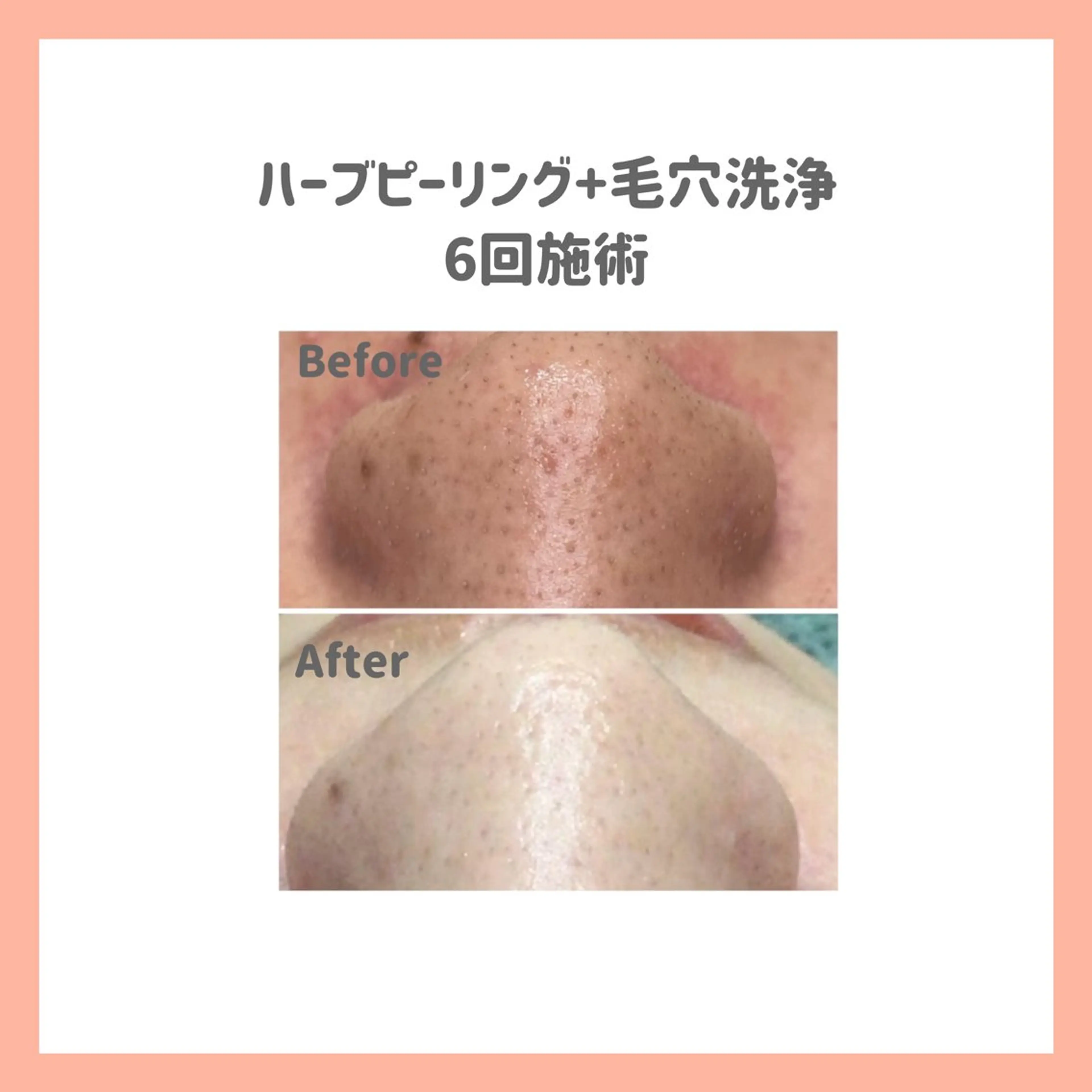 ハーブピーリング専門 muro.のエステ・リラクイメージ