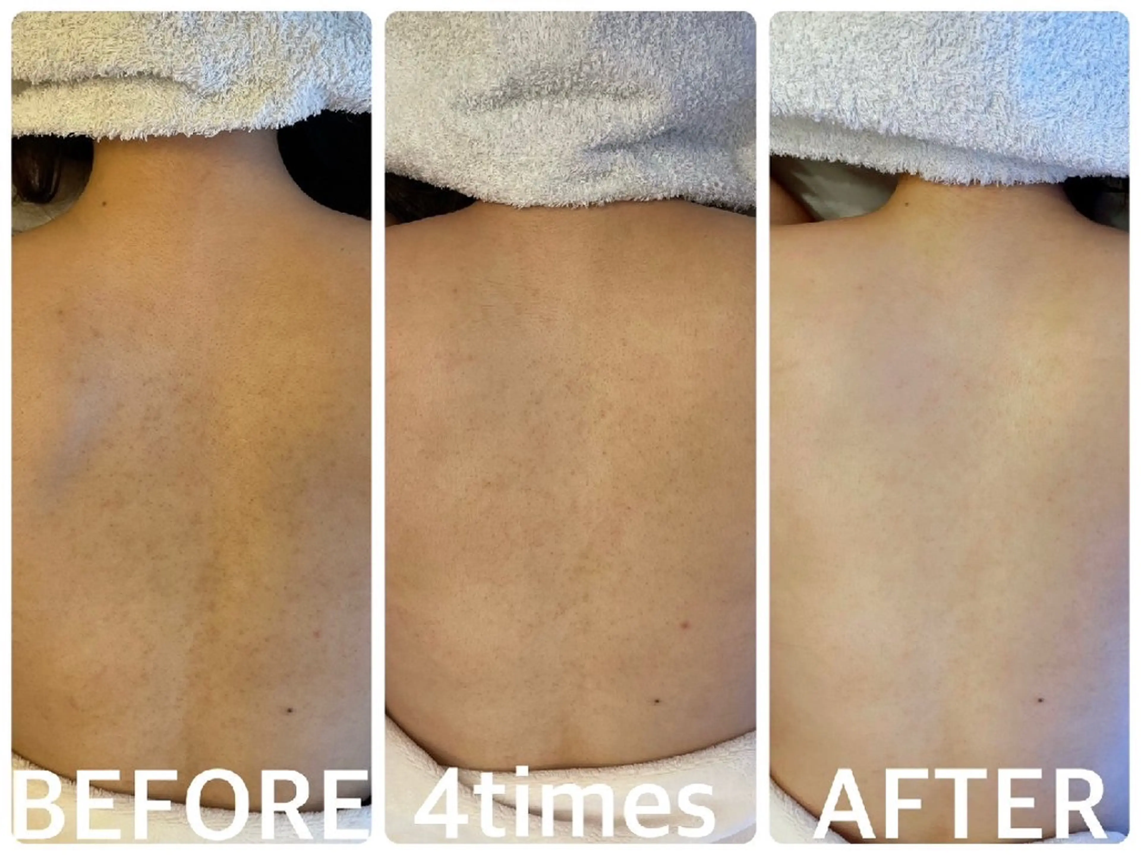 ハーブピーリング横浜 肌質改善専門店のその他イメージ