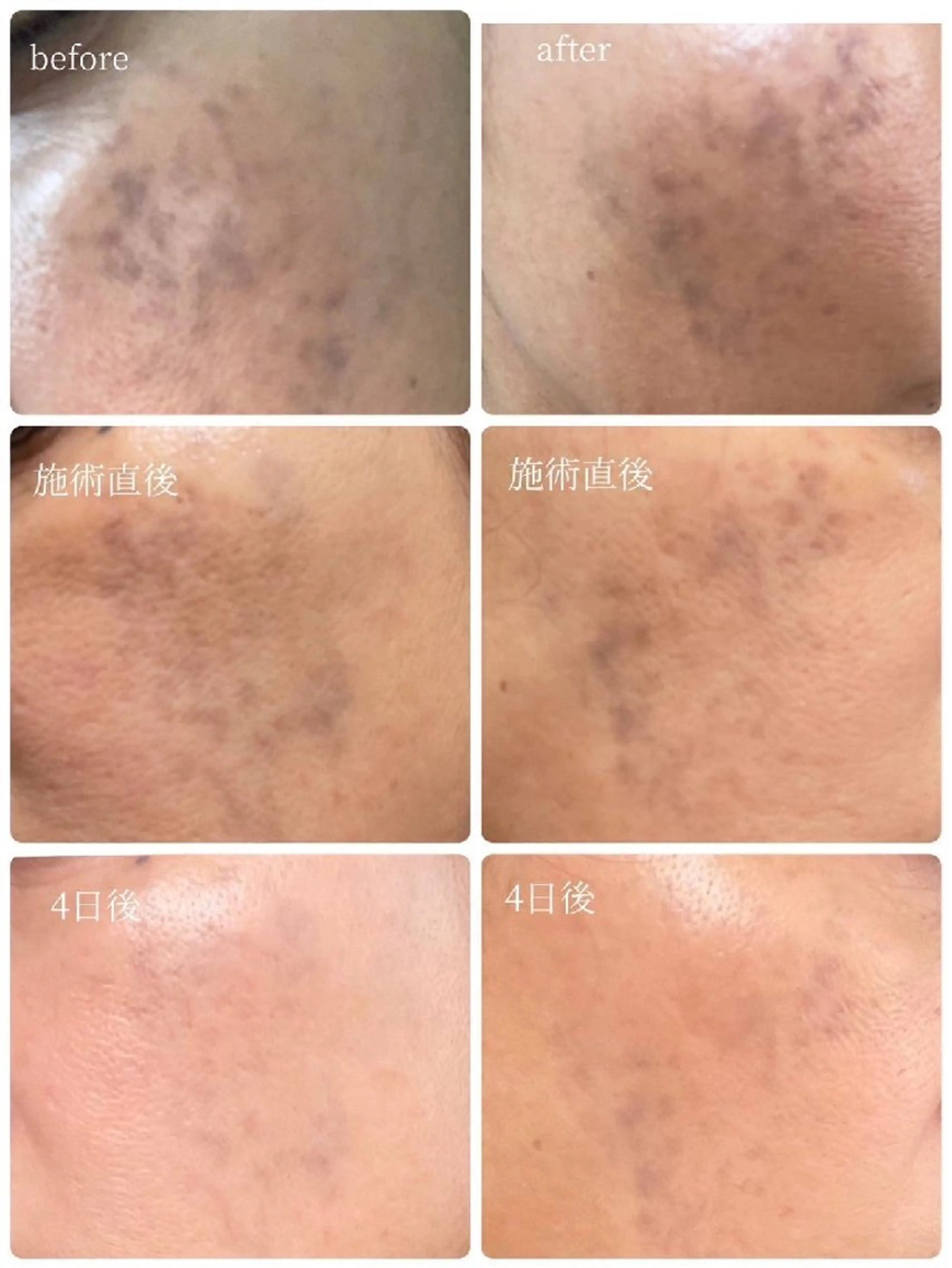 ビューティーサロン シェーラのマツエク・マツパデザイン