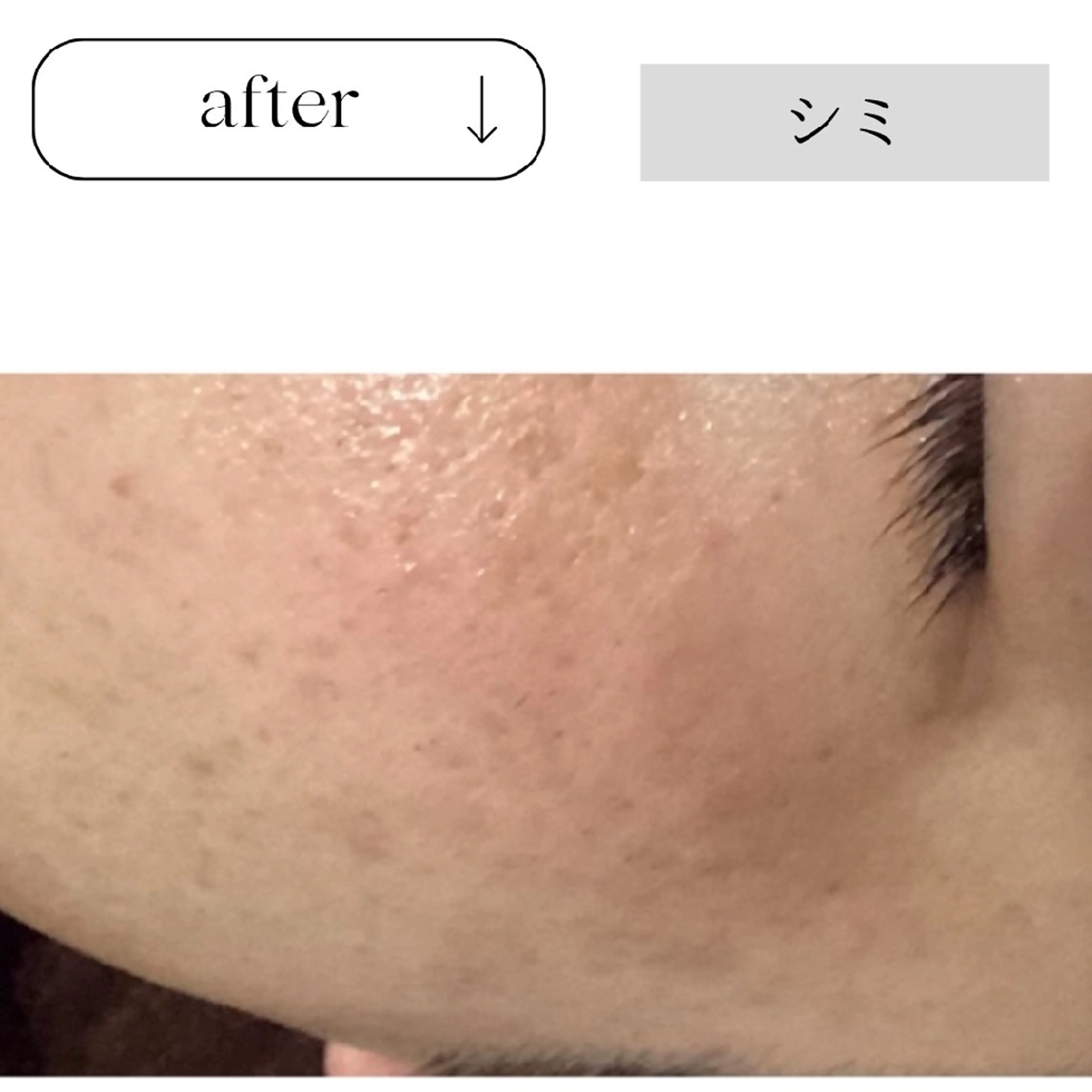 エステ ICHOOSE/ 代々木上原のエステ・リラクイメージ