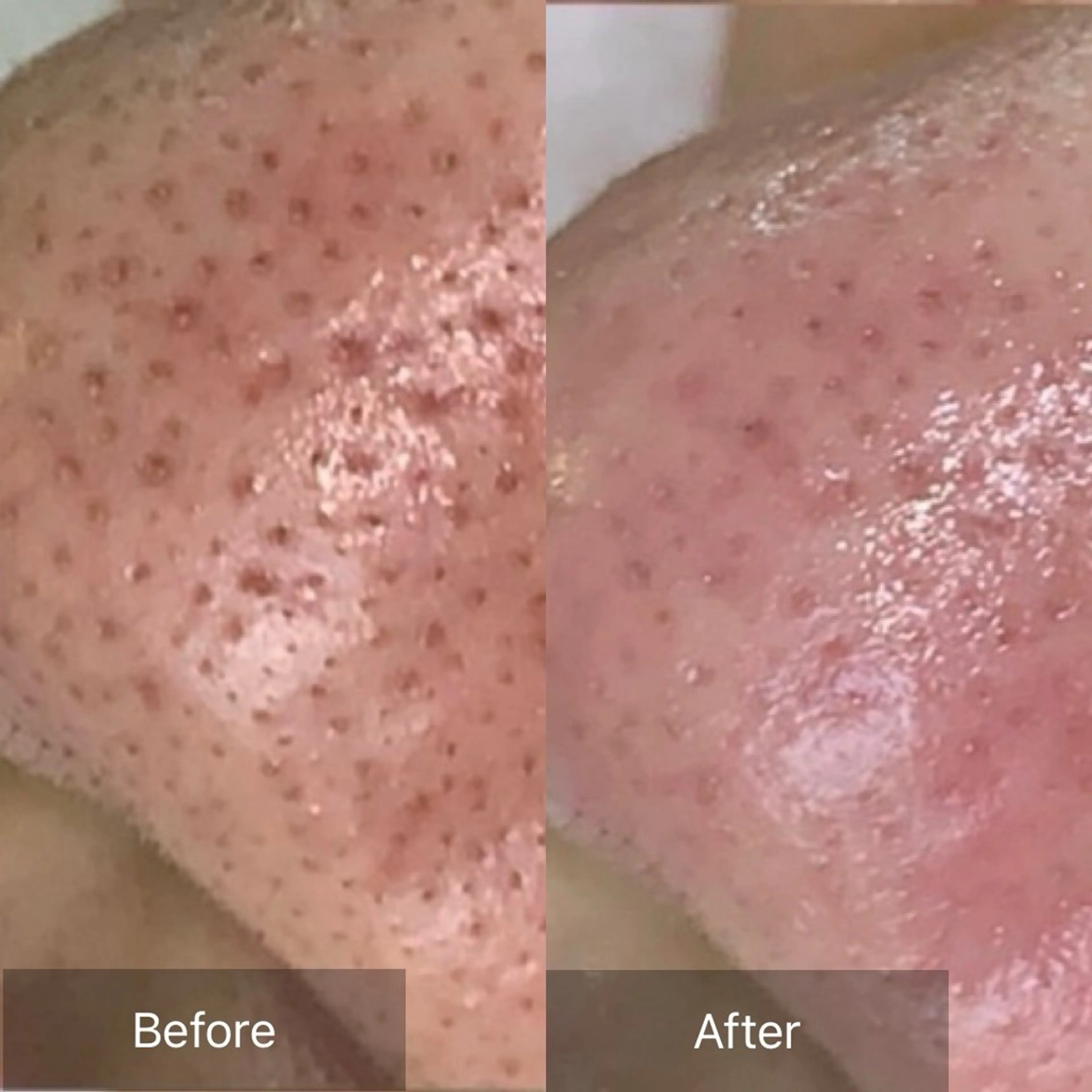 毛穴が見えなくなるサロン  Horo所属・岡 えり子のエステ・リラクイメージ