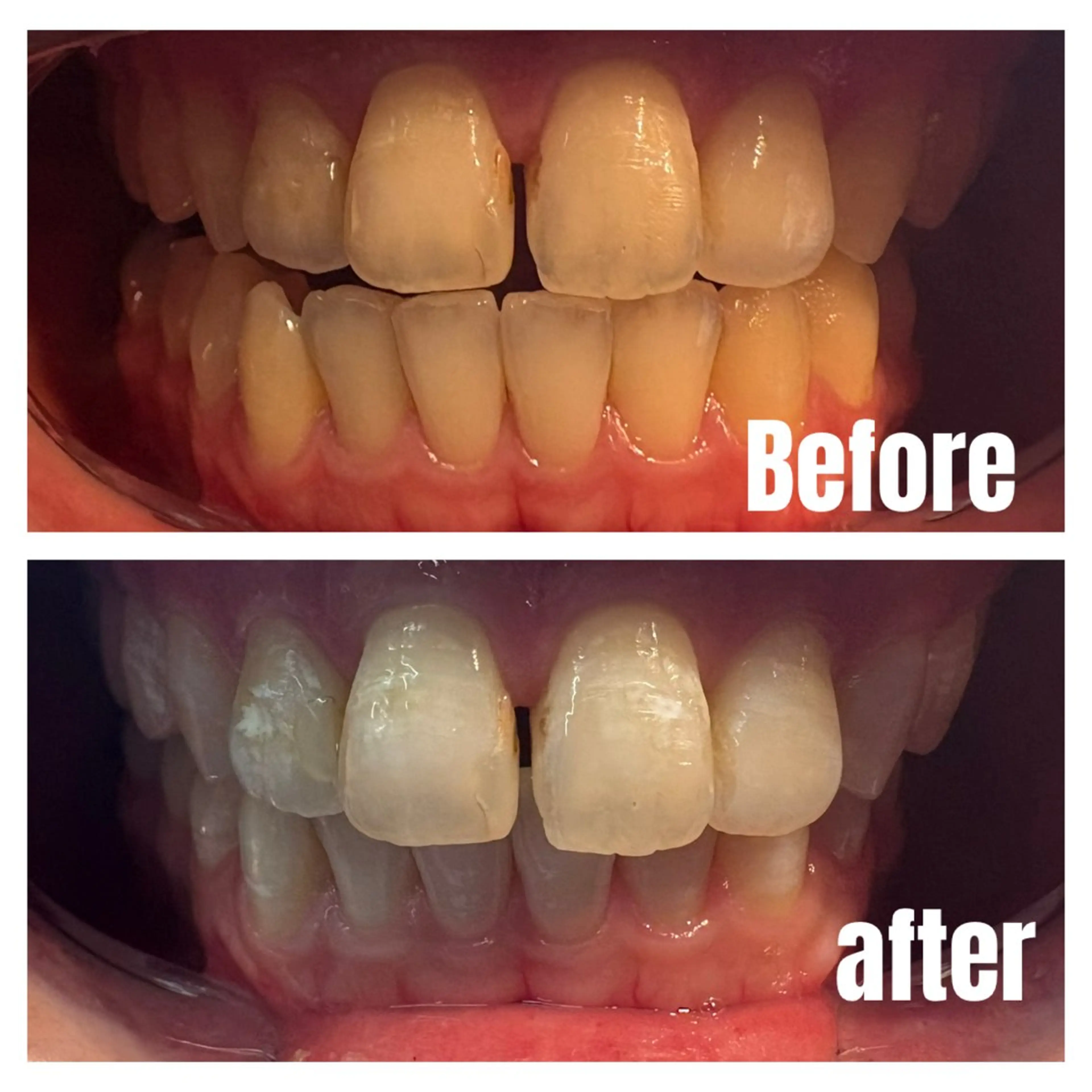 Kalama whitening salon所属・Kalamawhit eningsalonのその他イメージ