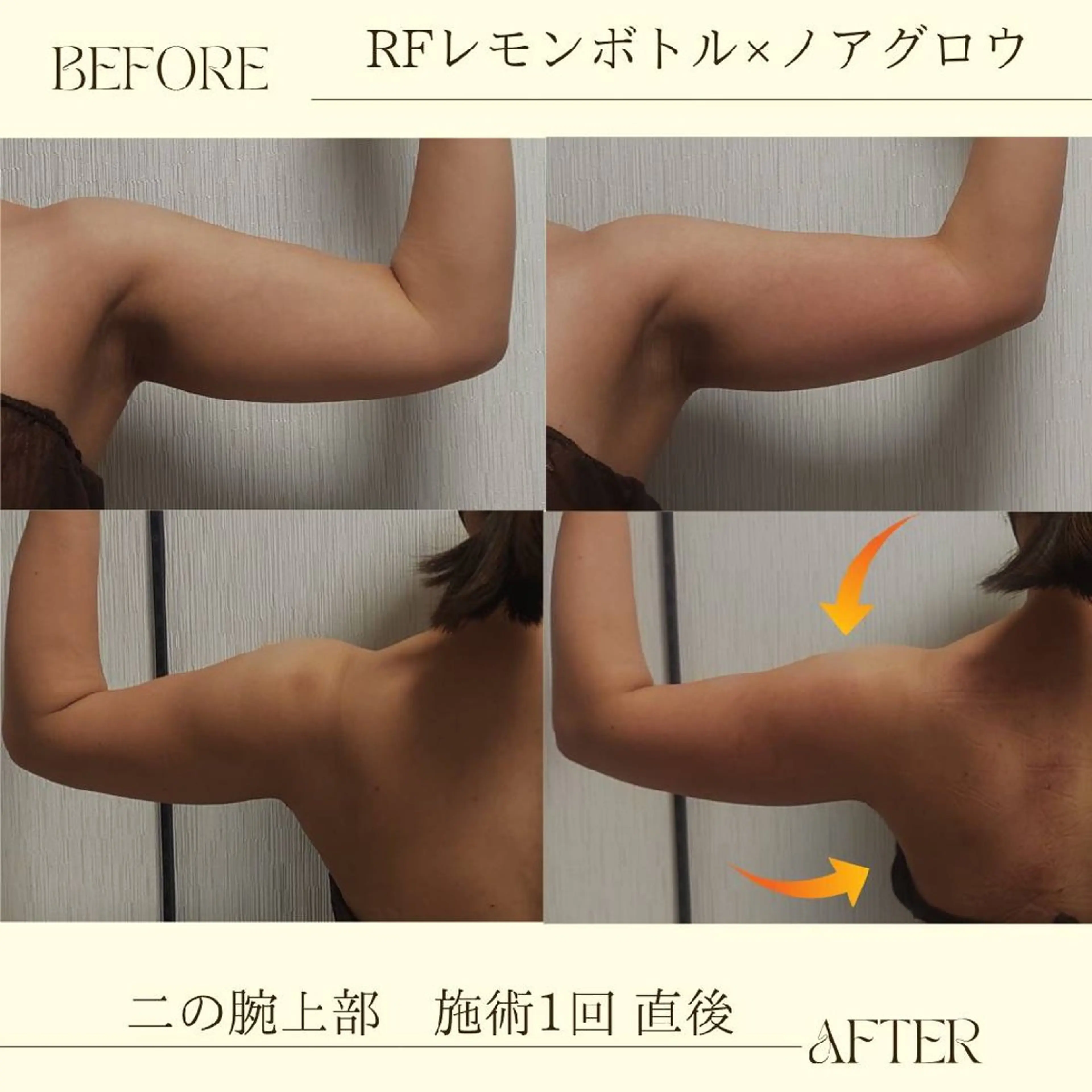 痩身小顔専門 アマテ ビューティー.Nのエステ・リラクイメージ