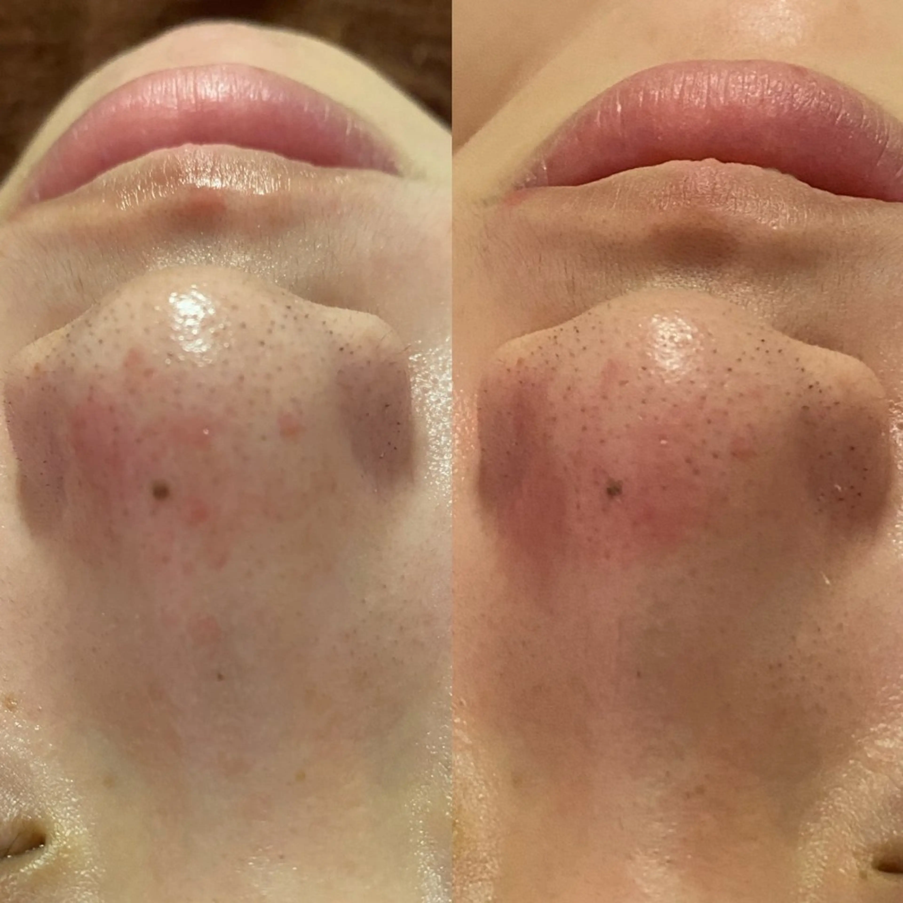 フェイシャルプチの写真