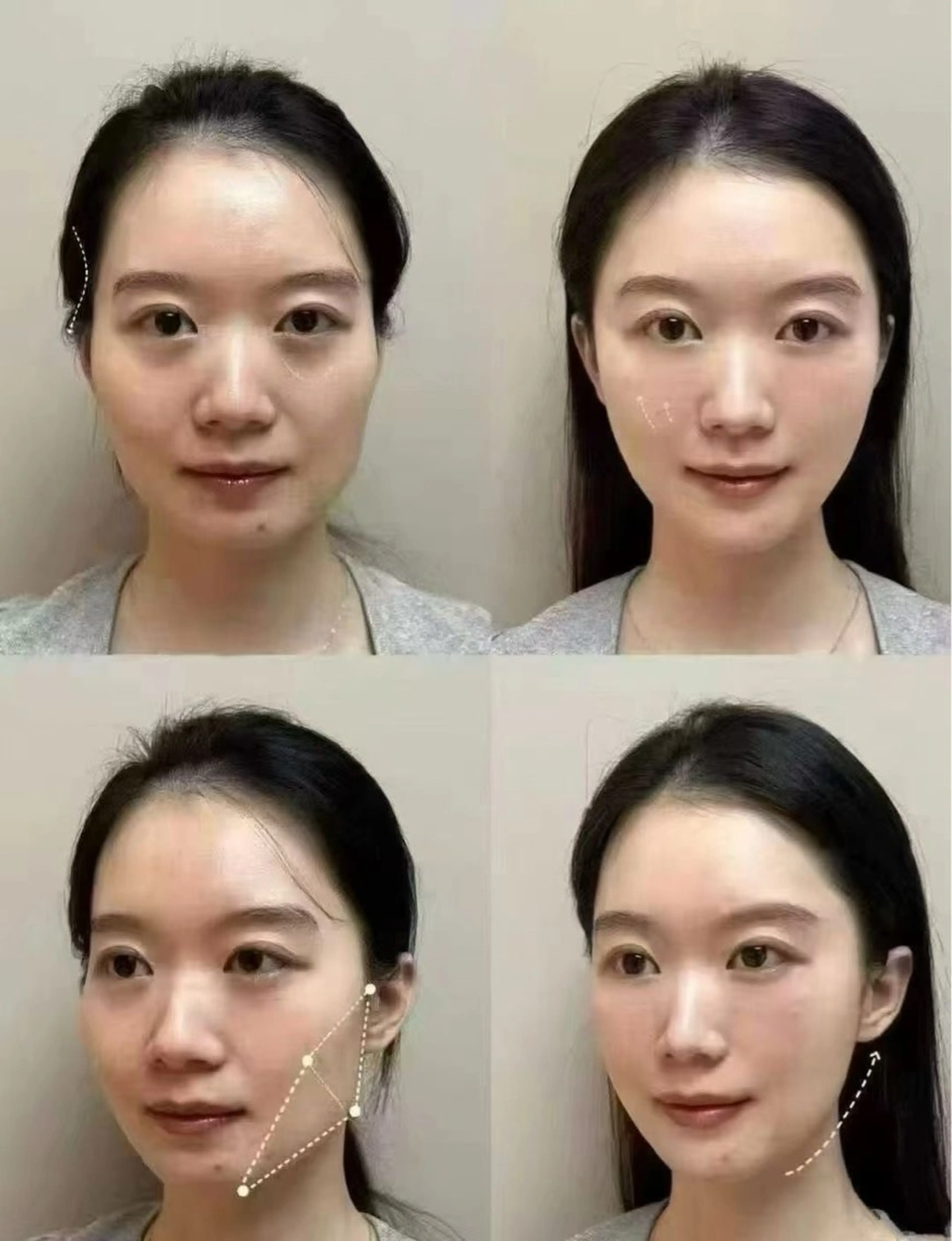 ショート その他 aliaハイフ&水光ジェットサロン所属・aliaハーブ水光店 エステティシャン募集のエステ・リラクイメージ