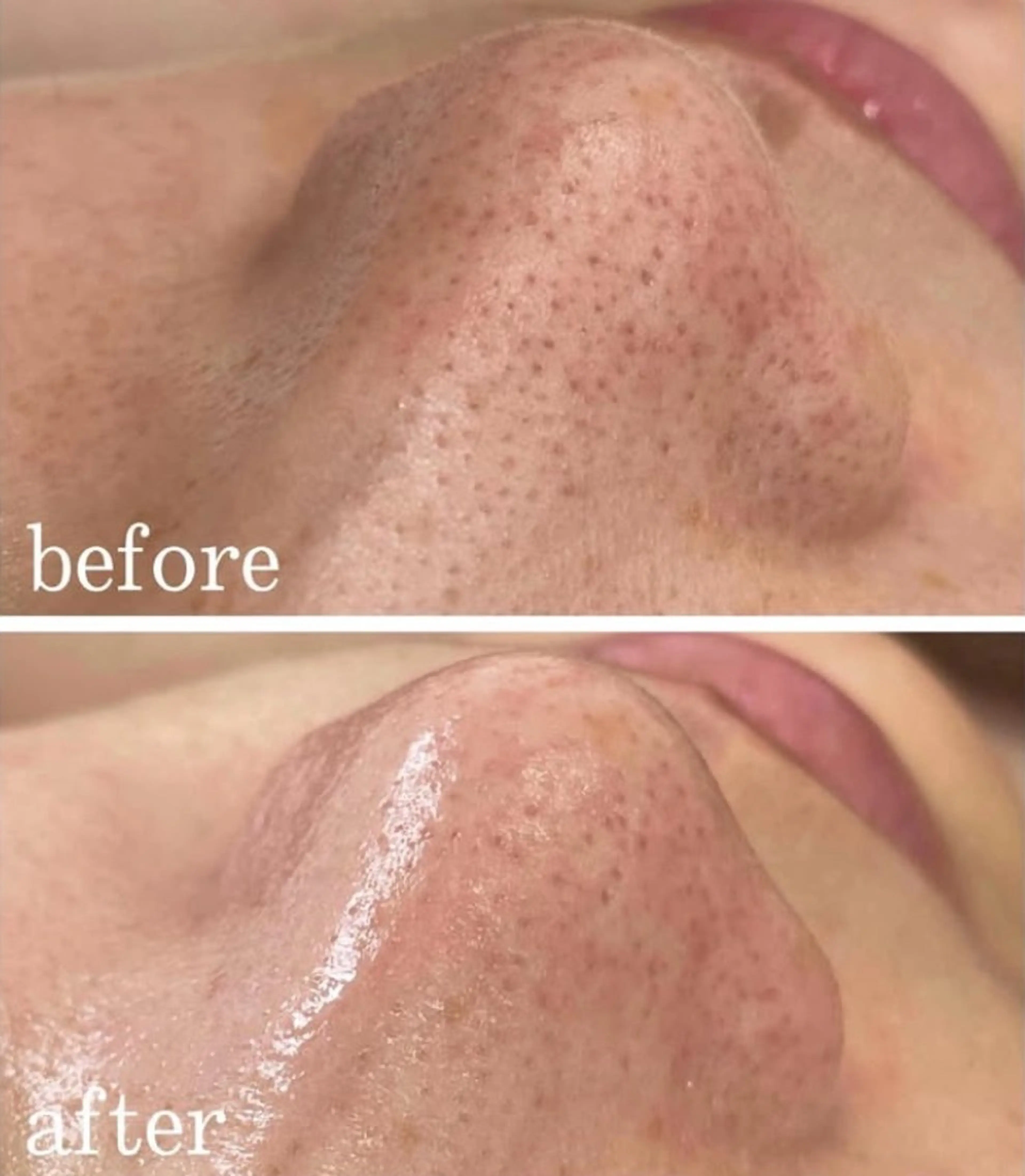 エステティック ロッカのエステ・リラクイメージ