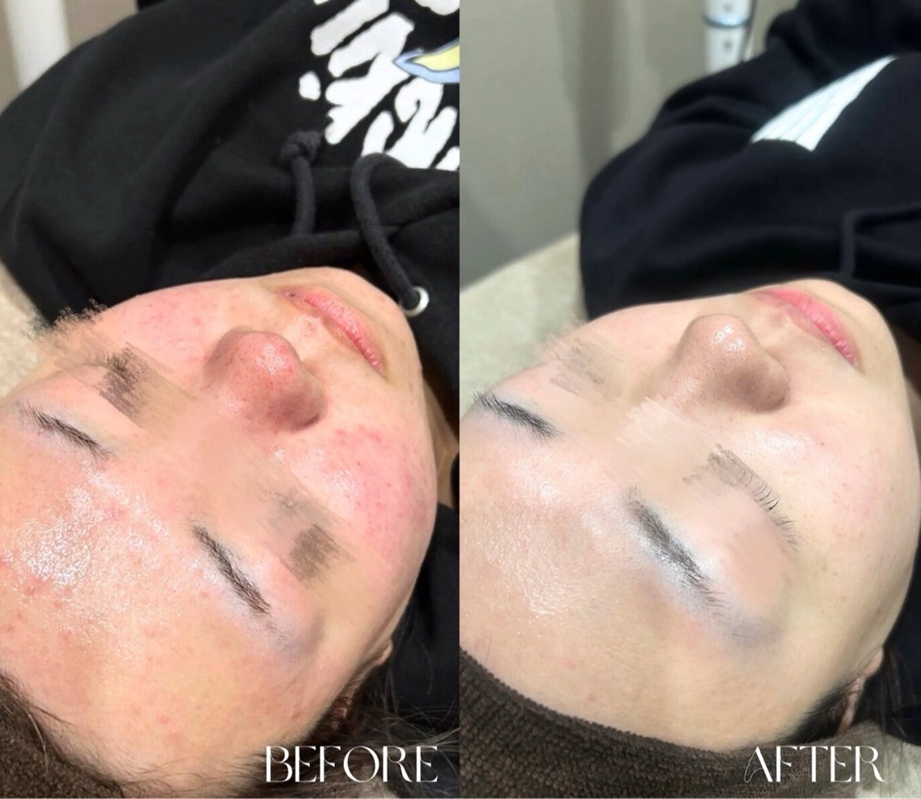 LUMIERE福岡春吉店所属・LUMIERE 福岡のエステ・リラクイメージ